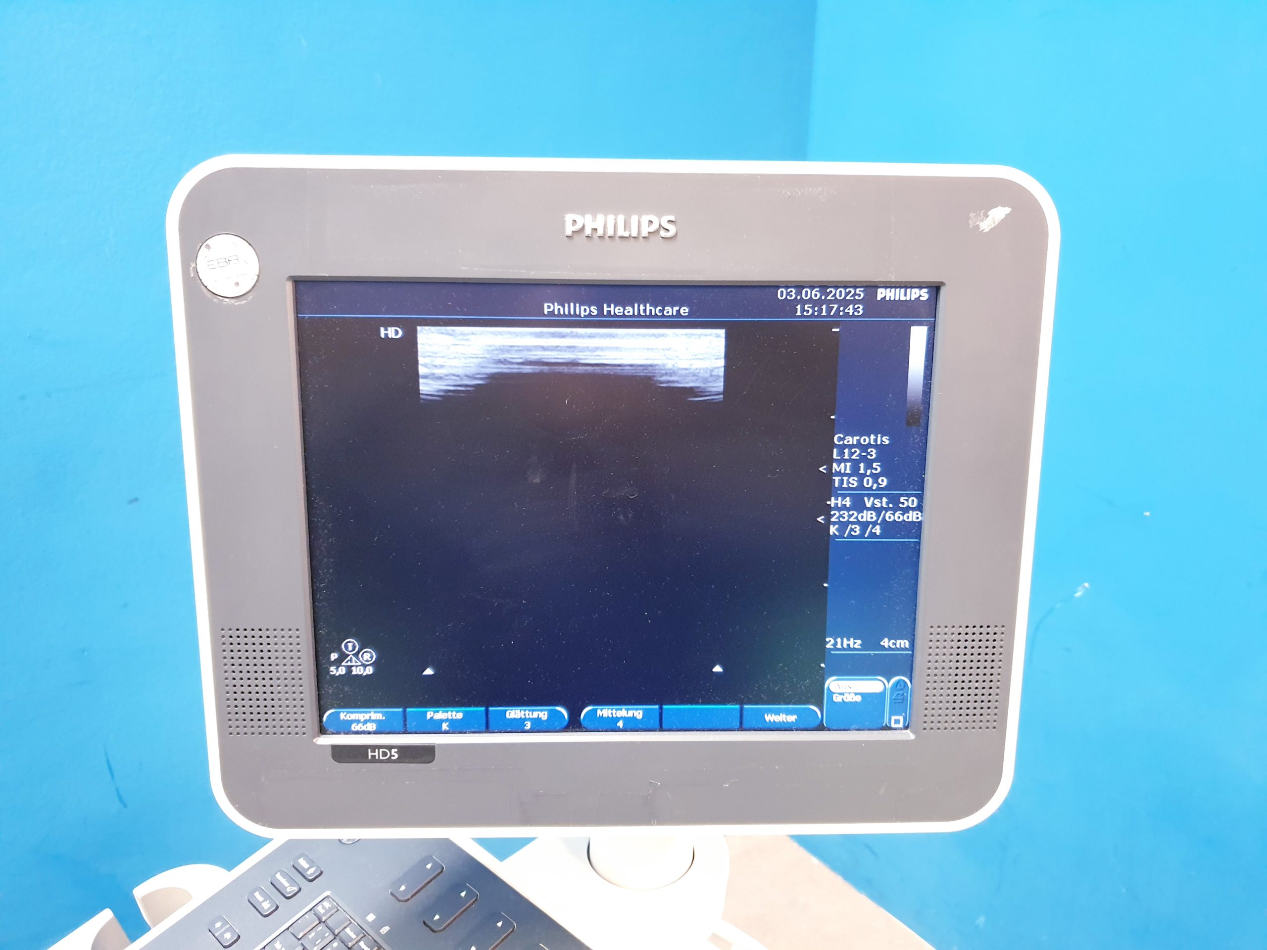 Philips HD 5 HD5 + C5-2 + C8-4v + L12-3 – Gynmaschine Farbdoppler – Bild 13