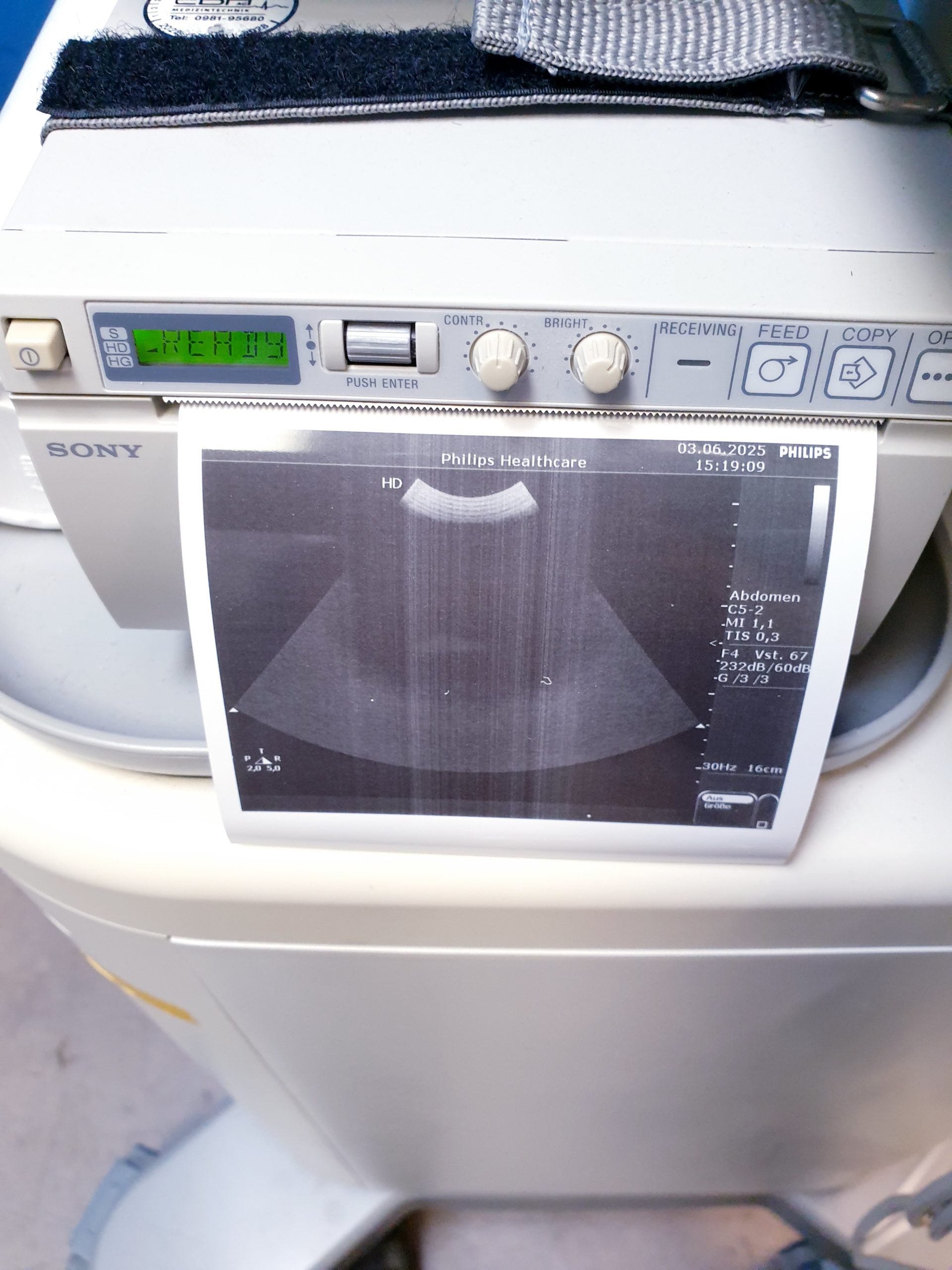 Philips HD 5 HD5 + C5-2 + C8-4v + L12-3 – Gynmaschine Farbdoppler – Bild 18