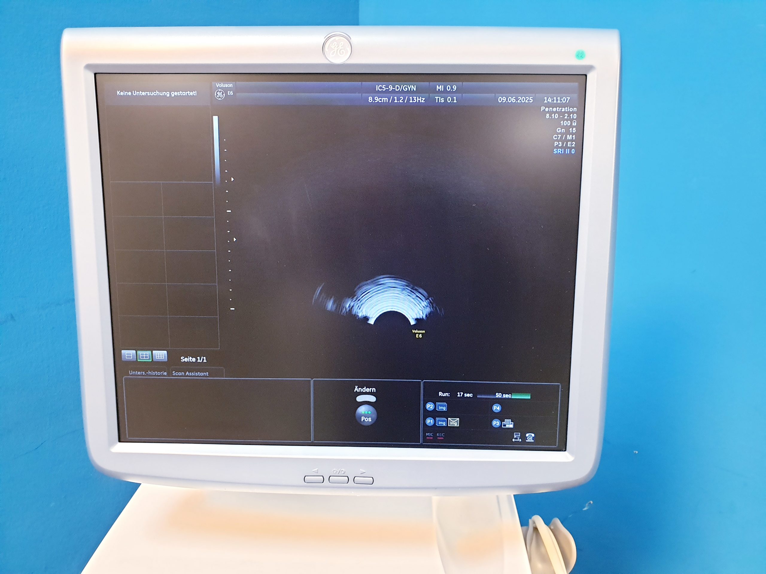 Ge Voluson E6 + RAB4-8-D + IC5-9D + 11L-D – 3D4D – Bild 10