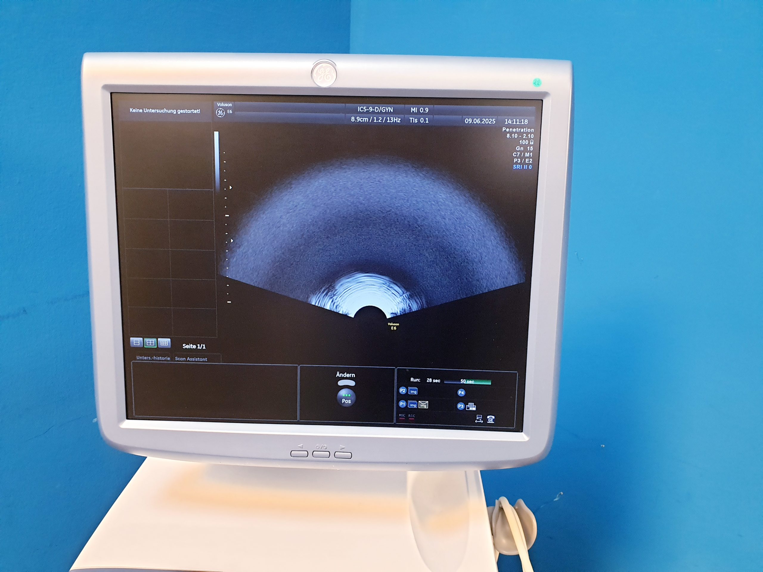 Ge Voluson E6 + RAB4-8-D + IC5-9D + 11L-D – 3D4D – Bild 11