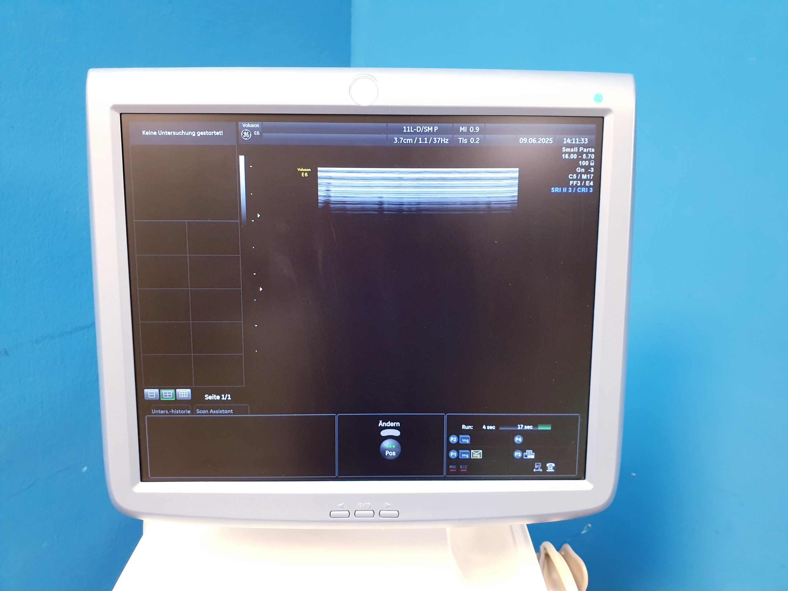 Ge Voluson E6 + RAB4-8-D + IC5-9D + 11L-D – 3D4D – Bild 13