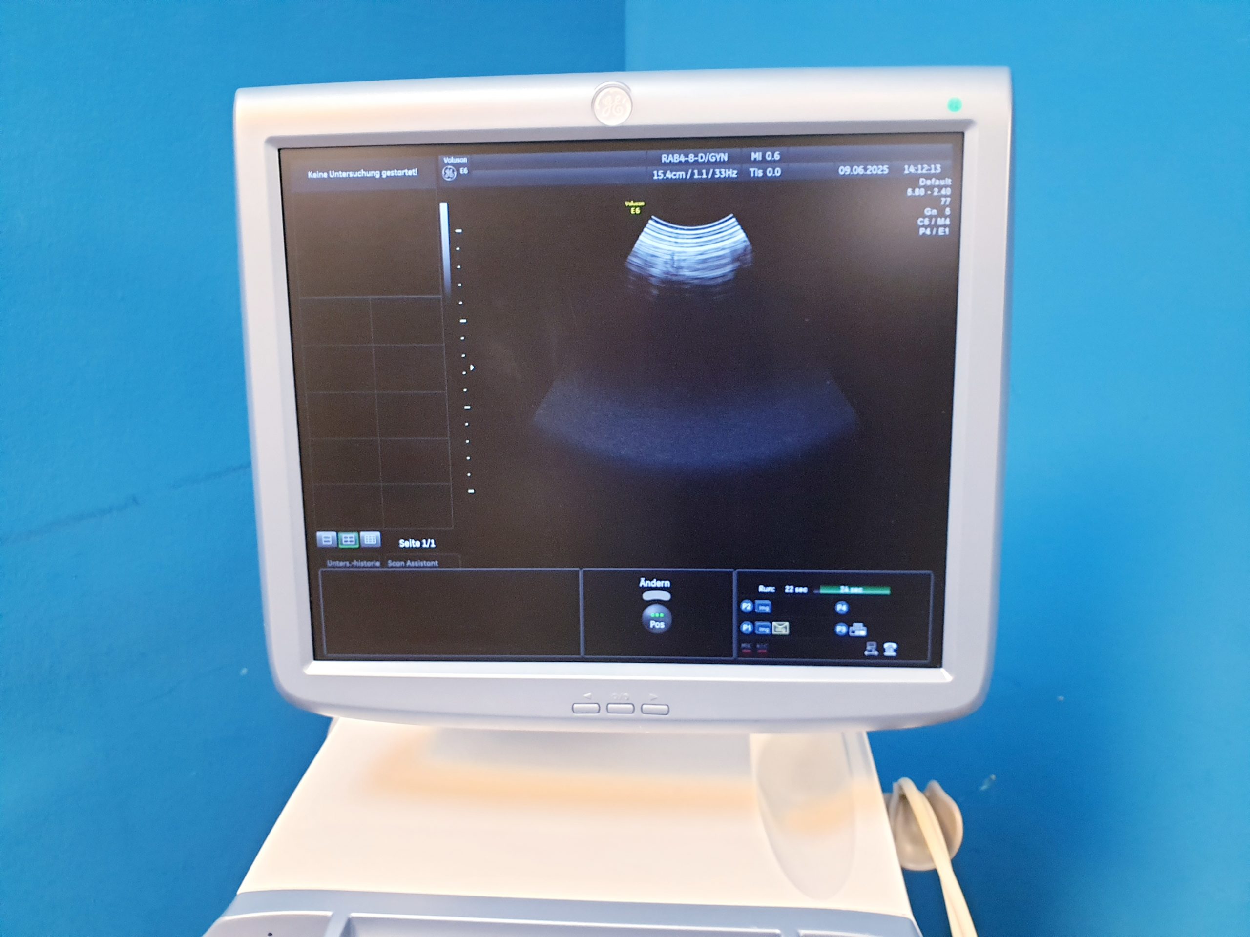 Ge Voluson E6 + RAB4-8-D + IC5-9D + 11L-D – 3D4D – Bild 15