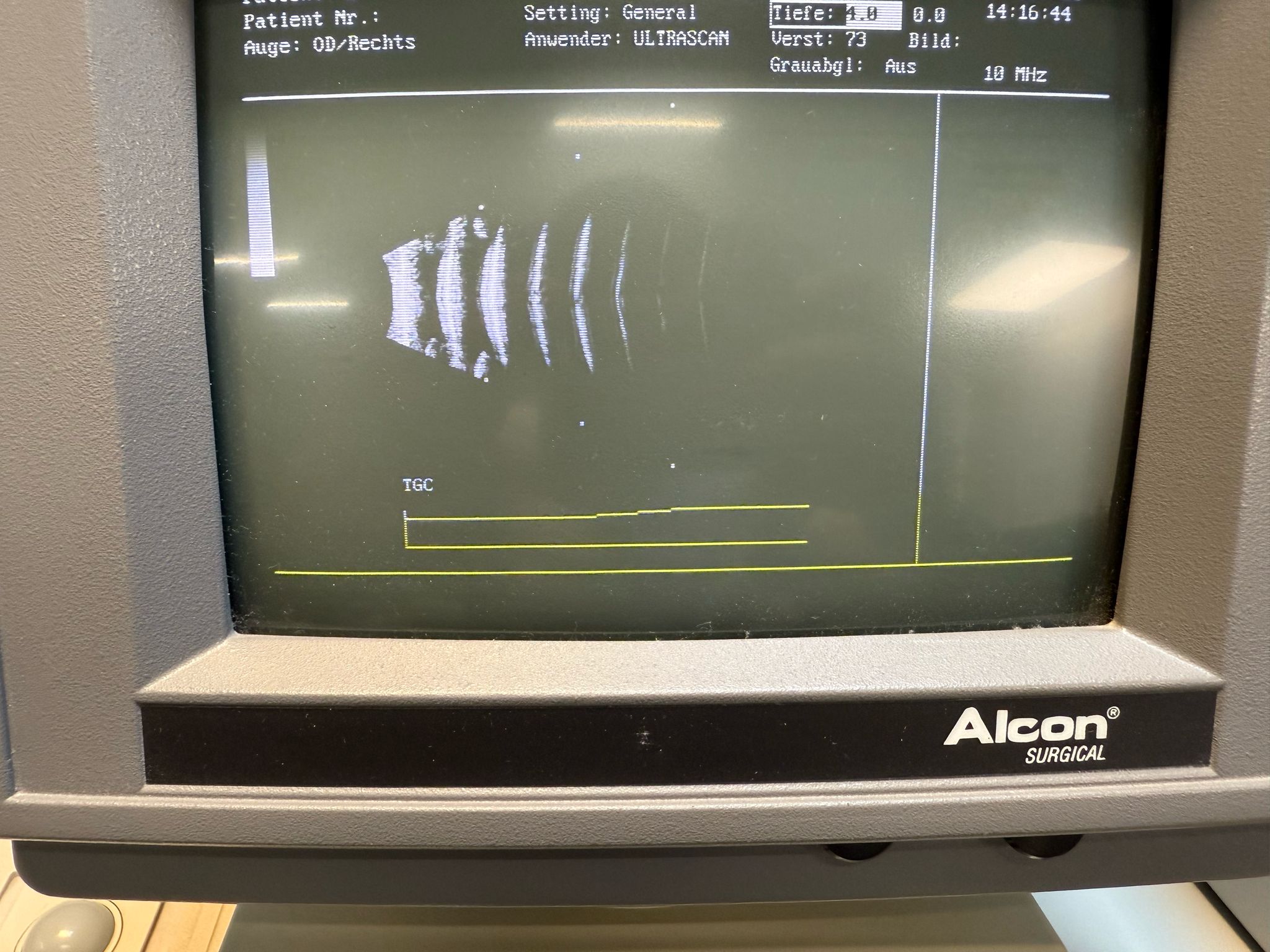 Alcon Ultrascan B-Scan und Biometer – Bild 20