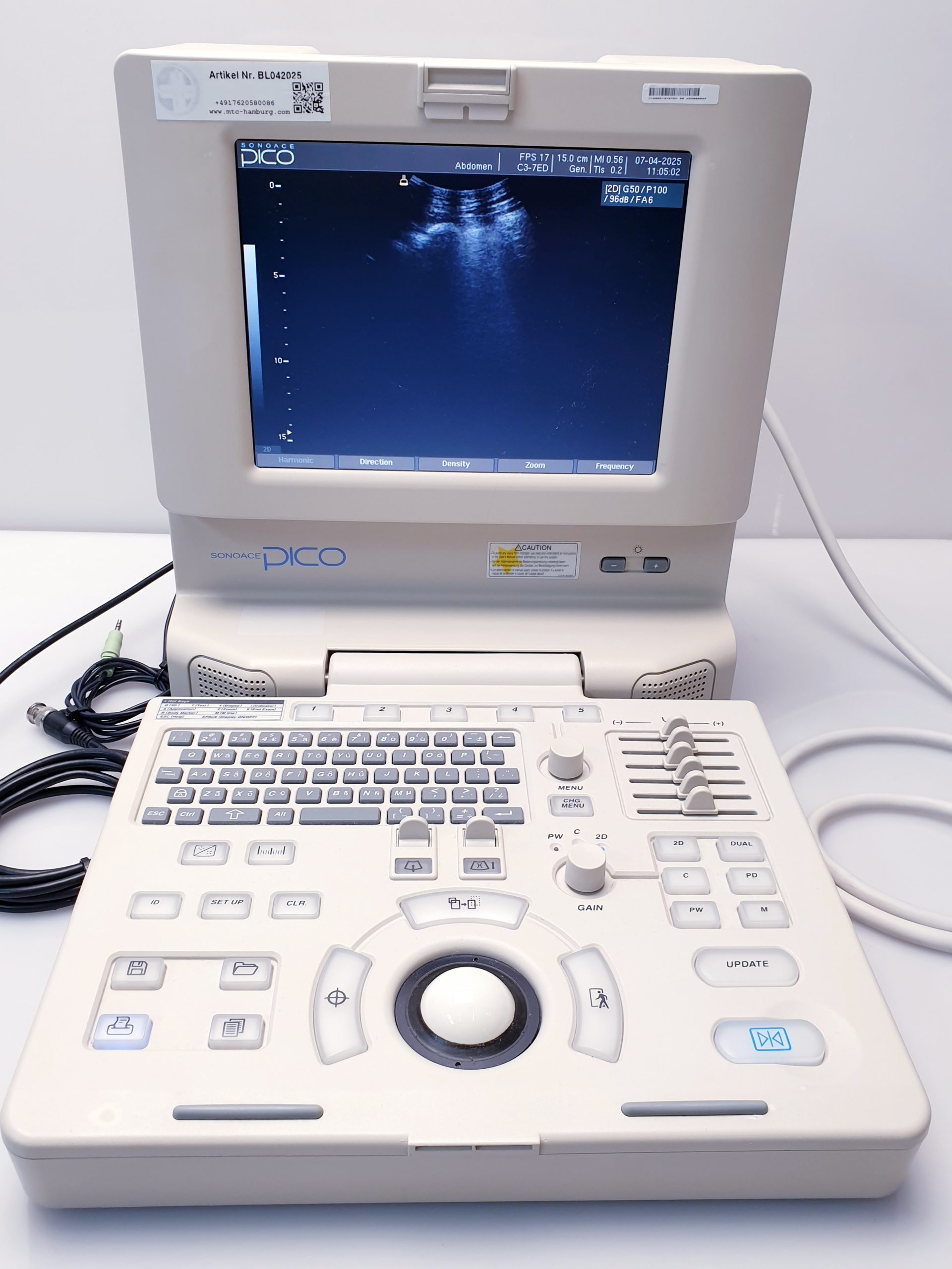 Medison SonoAce PICO tragbarer Ultraschall + C3-7ED Konvex + HL5-9ED Linear – Bild 7