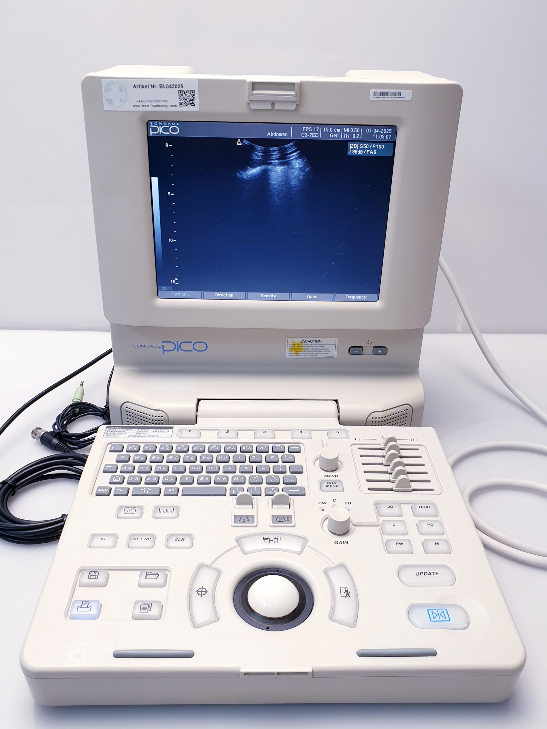 Medison SonoAce PICO tragbarer Ultraschall + C3-7ED Konvex + HL5-9ED Linear – Bild 8