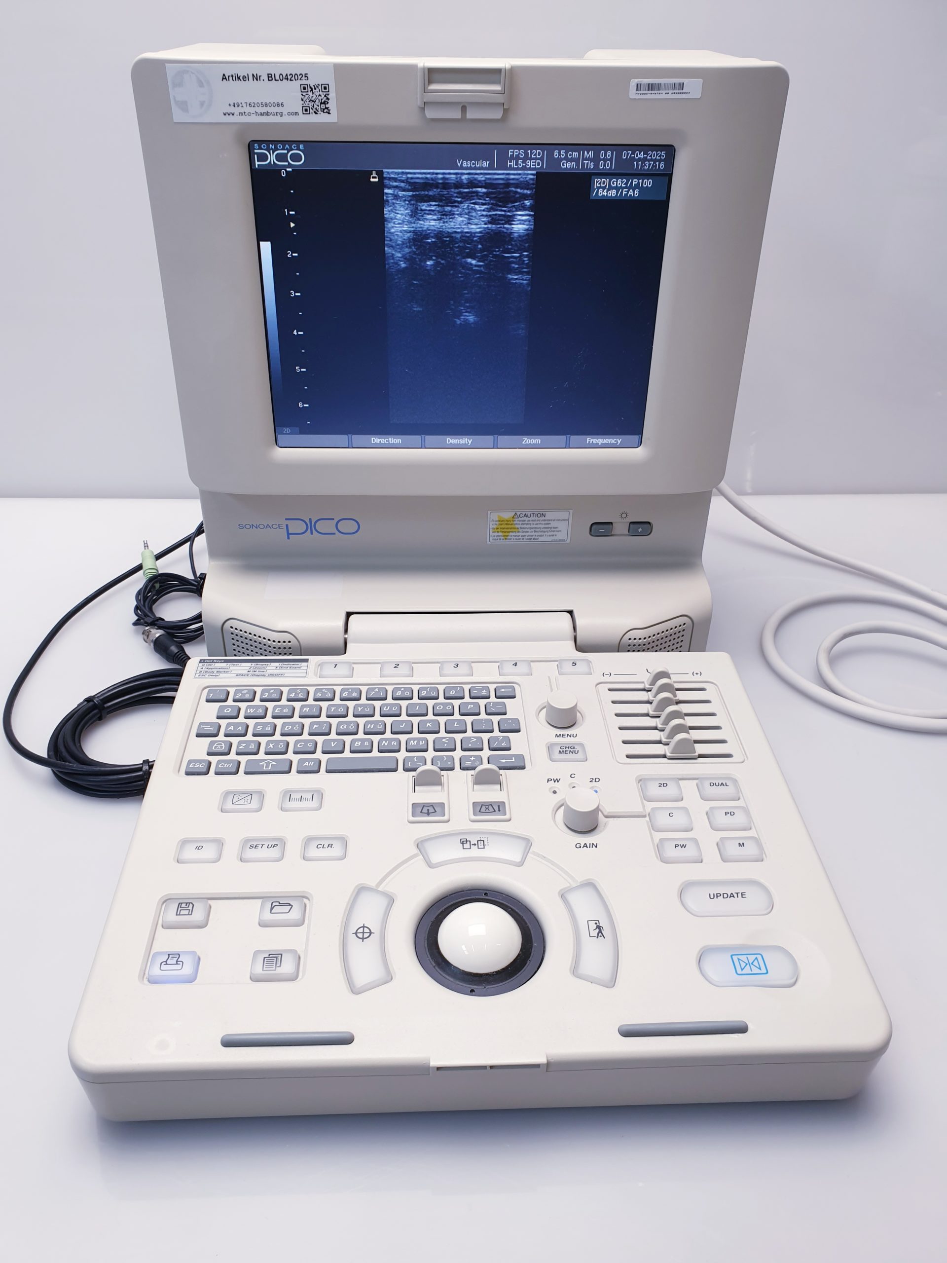 Medison SonoAce PICO tragbarer Ultraschall + C3-7ED Konvex + HL5-9ED Linear – Bild 16