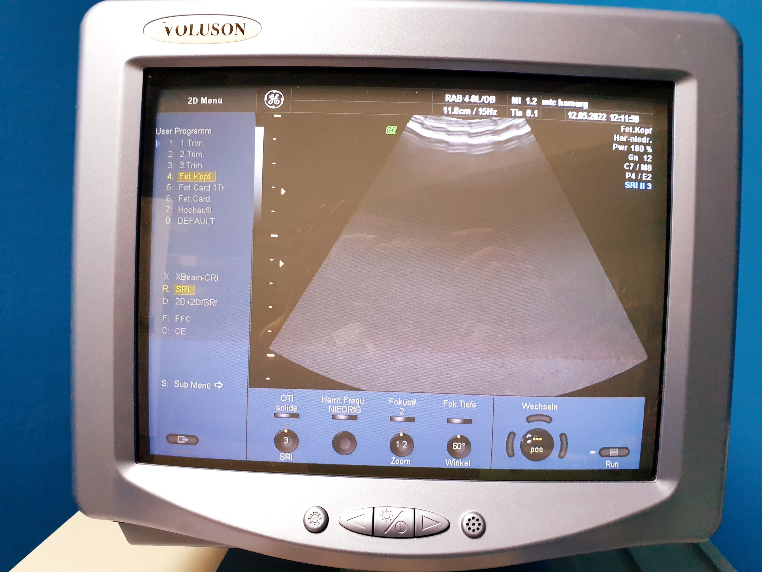 GE VOLUSON 730 Pro 730Pro + RAB4-8L + SP6-12 + IC5-9H + PA6-8 – Bild 7