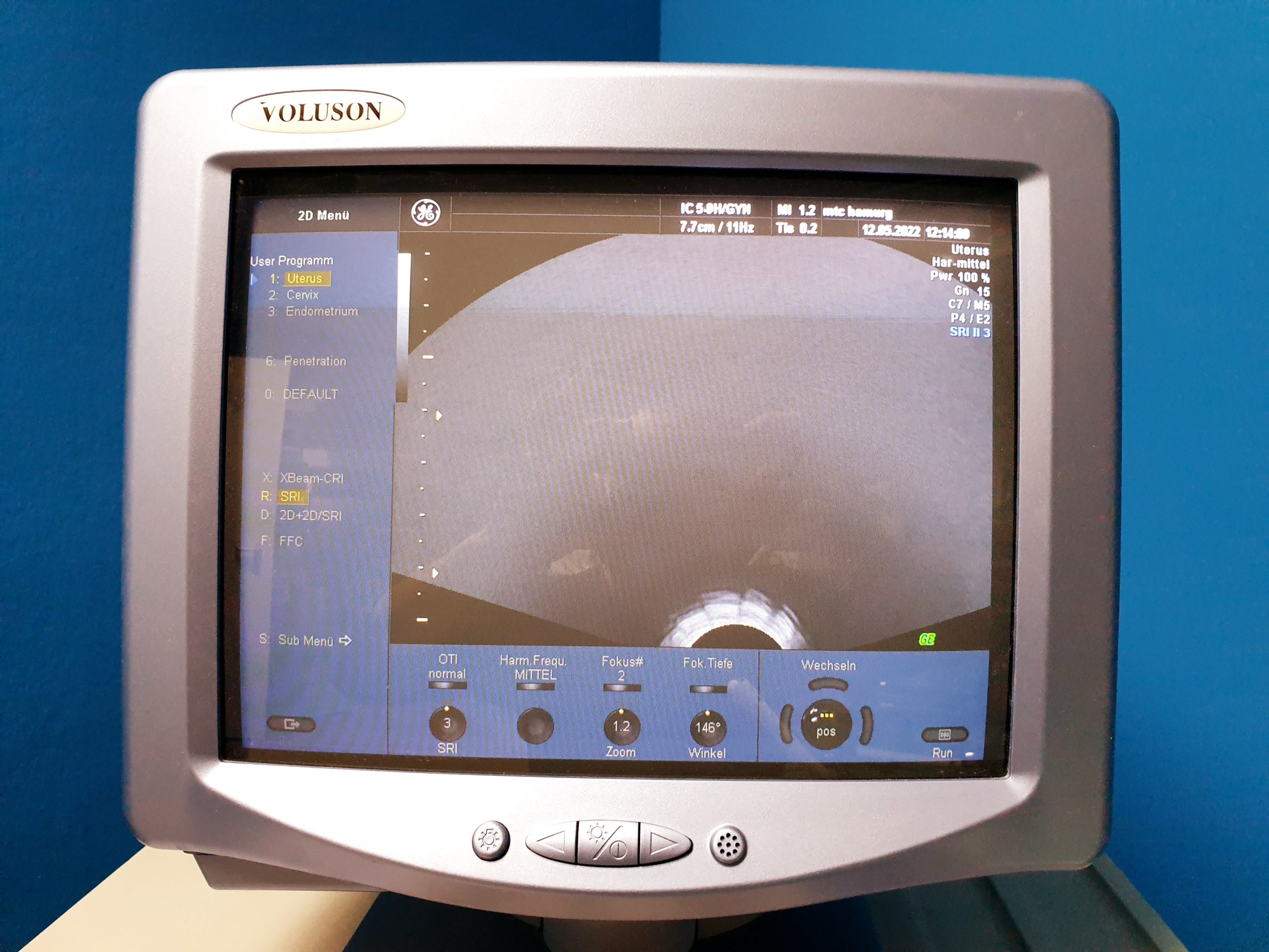 GE VOLUSON 730 Pro 730Pro + RAB4-8L + SP6-12 + IC5-9H + PA6-8 – Bild 11