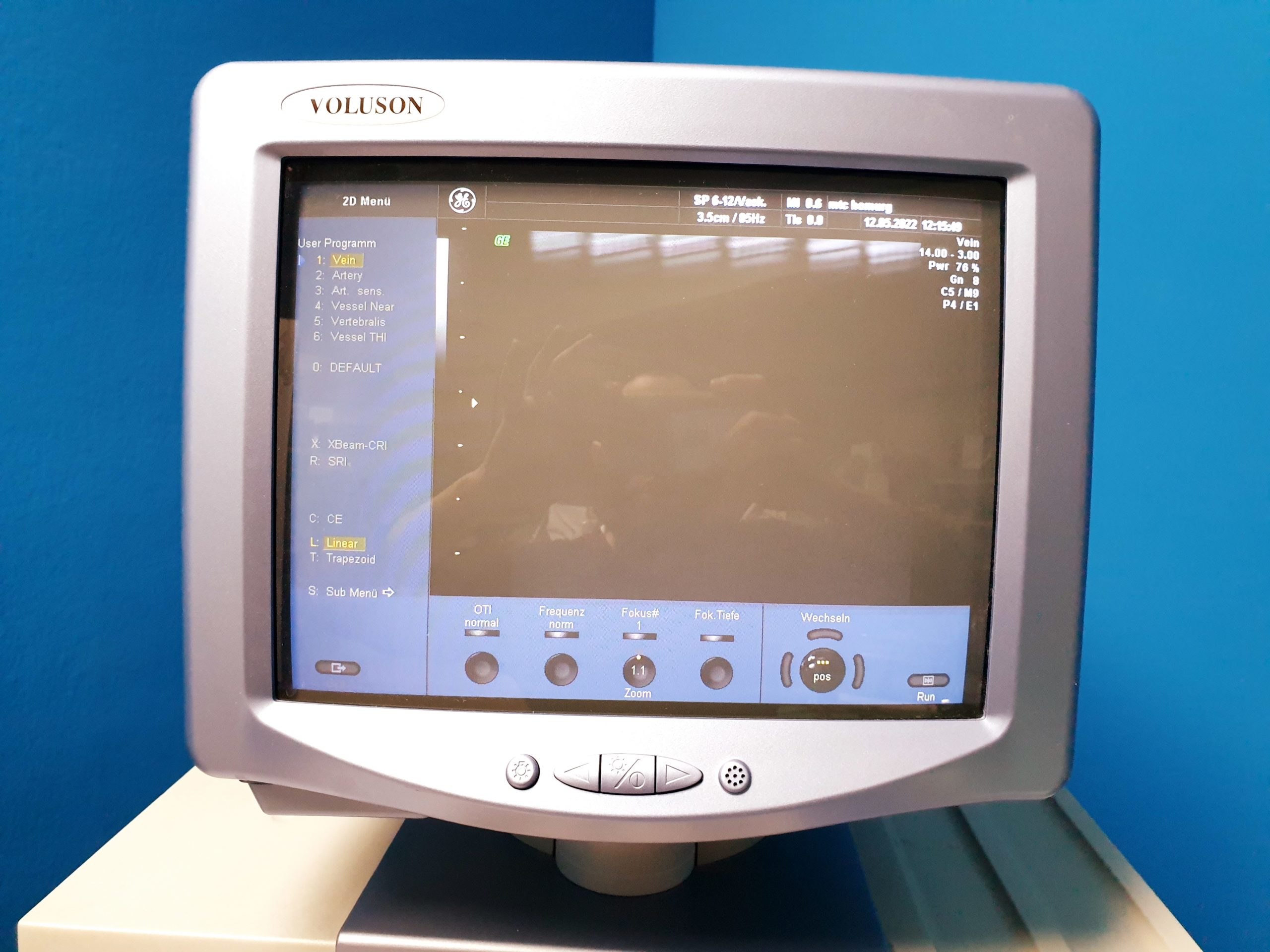 GE VOLUSON 730 Pro 730Pro + RAB4-8L + SP6-12 + IC5-9H + PA6-8 – Bild 15