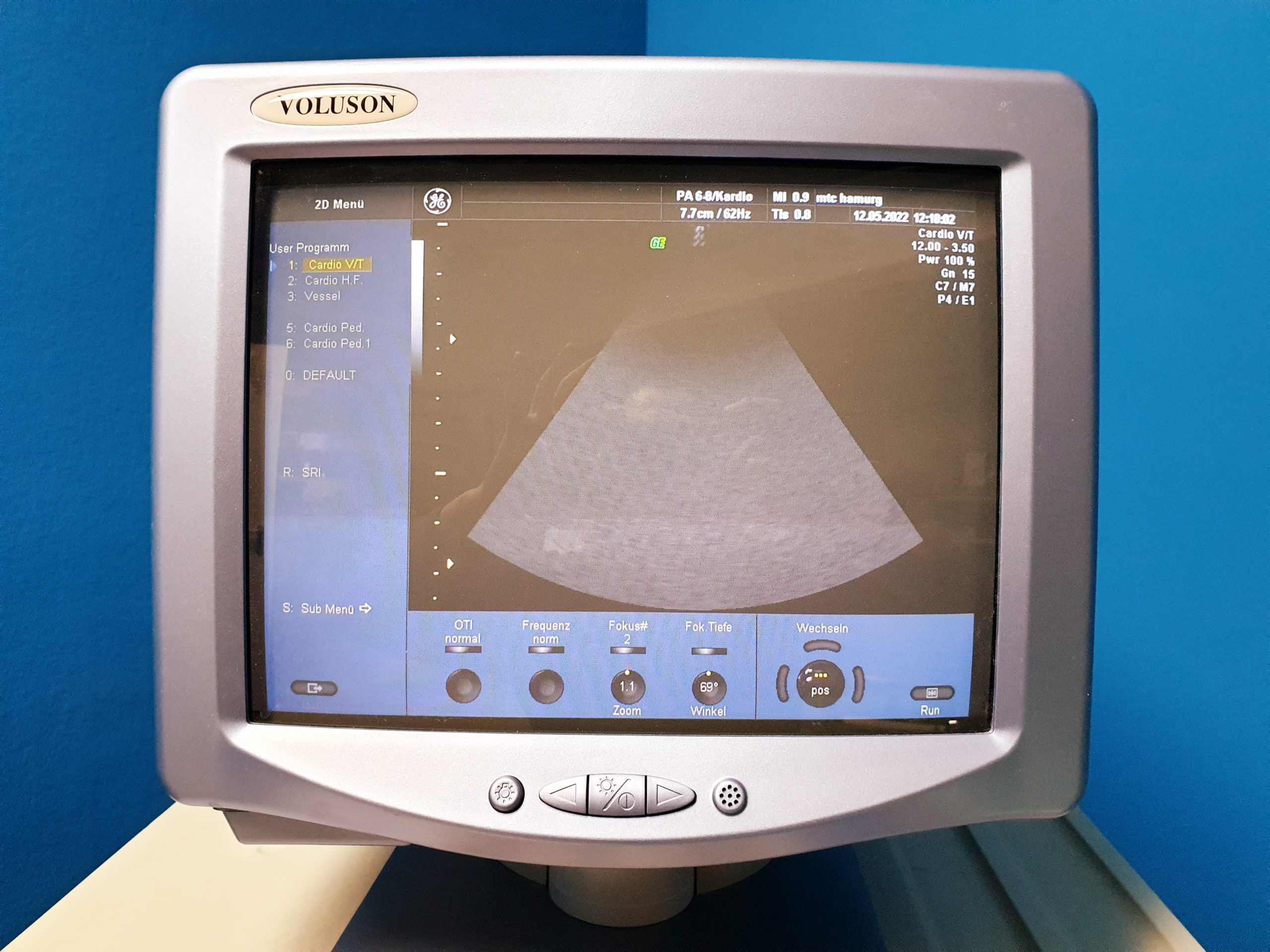 GE VOLUSON 730 Pro 730Pro + RAB4-8L + SP6-12 + IC5-9H + PA6-8 – Bild 18