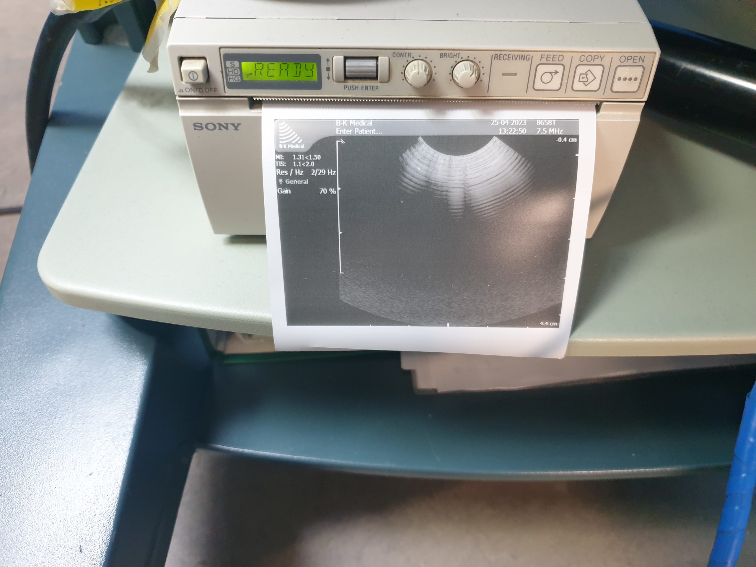 L042023-K B-K Medical Type 8658T & 8658S Ultrasound Transducer – Bild 5