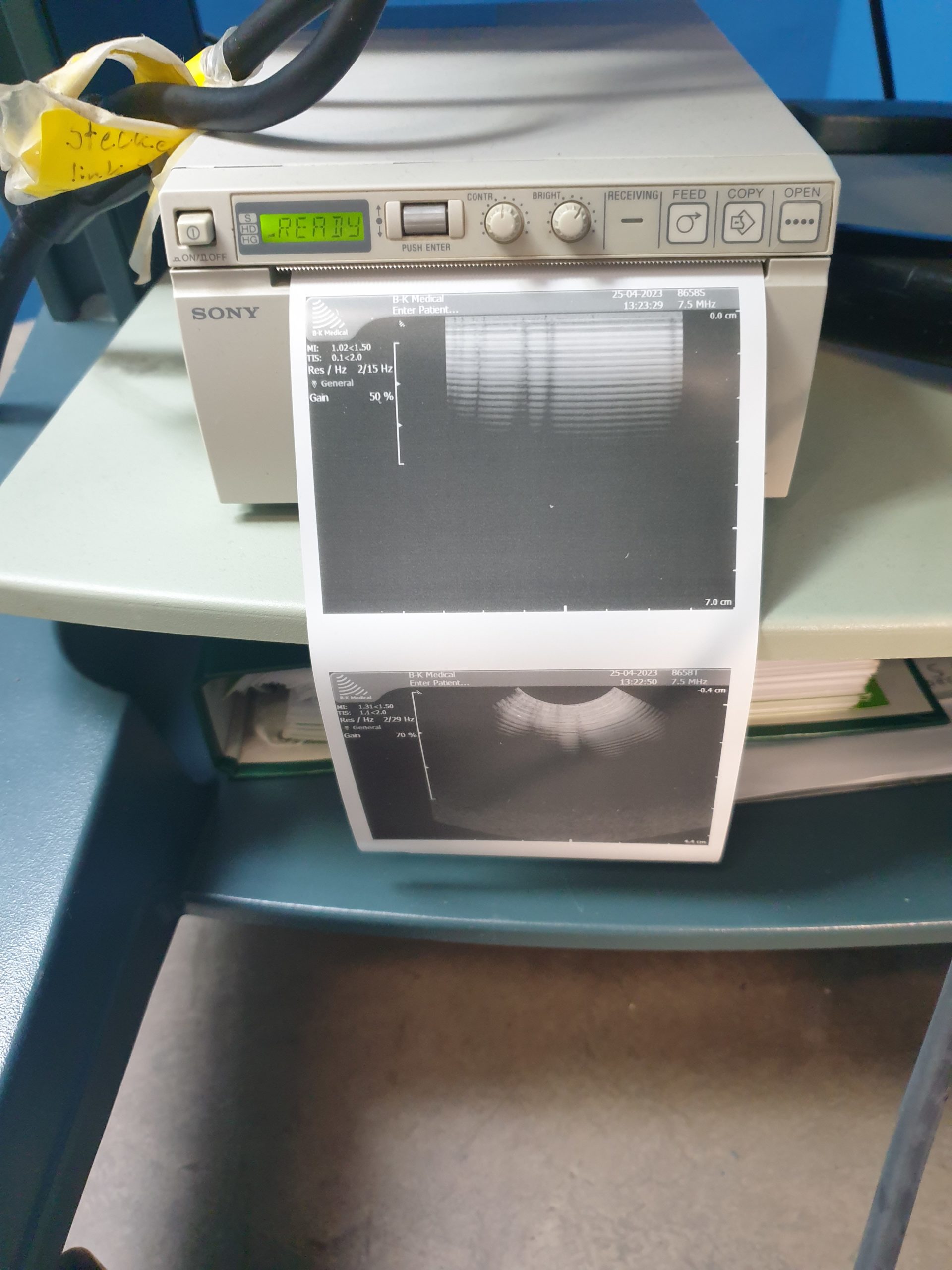 L042023-K B-K Medical Type 8658T & 8658S Ultrasound Transducer – Bild 8