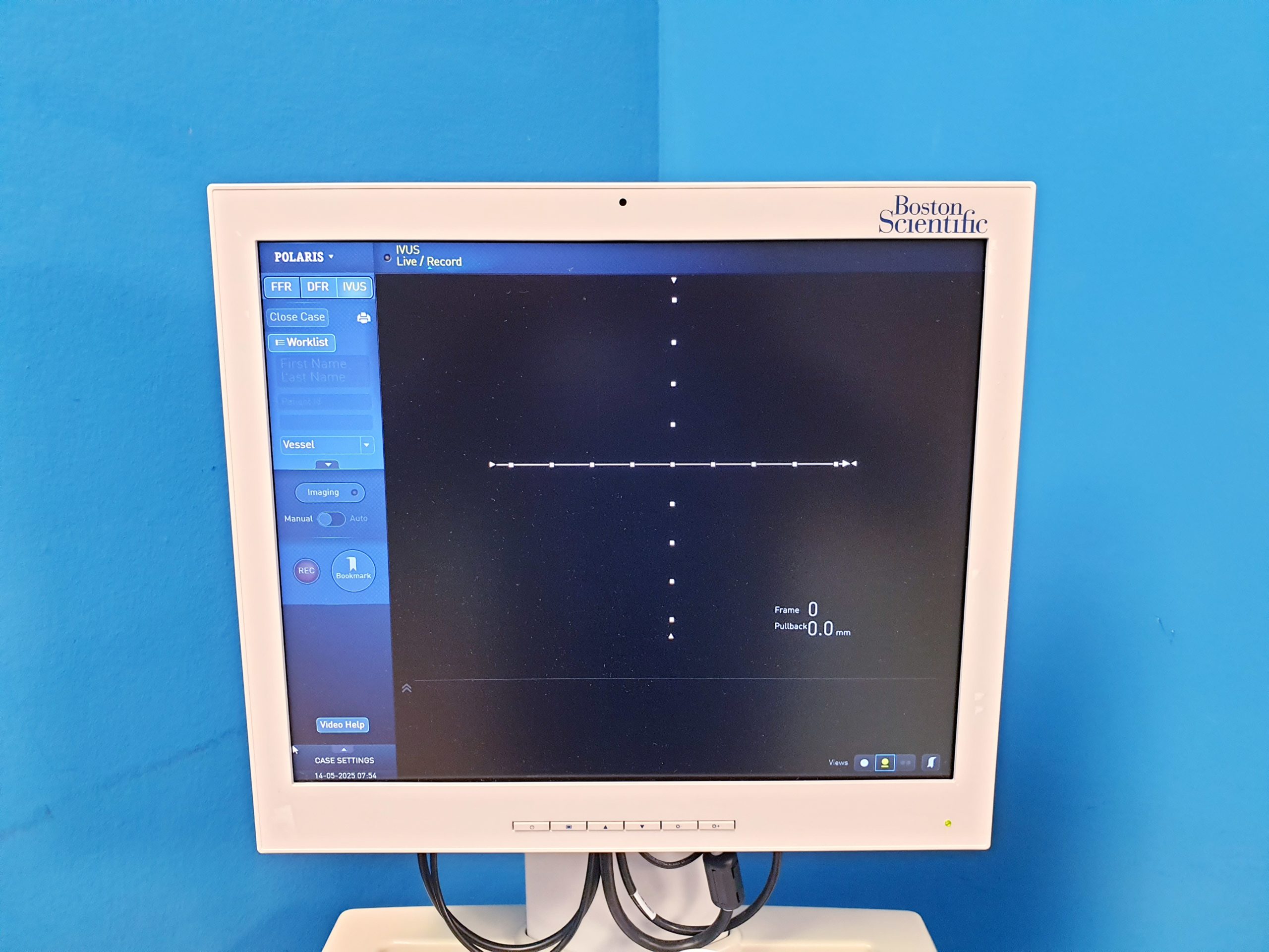 Boston Scientific iLab Ultrasound Imaging System – Bild 8