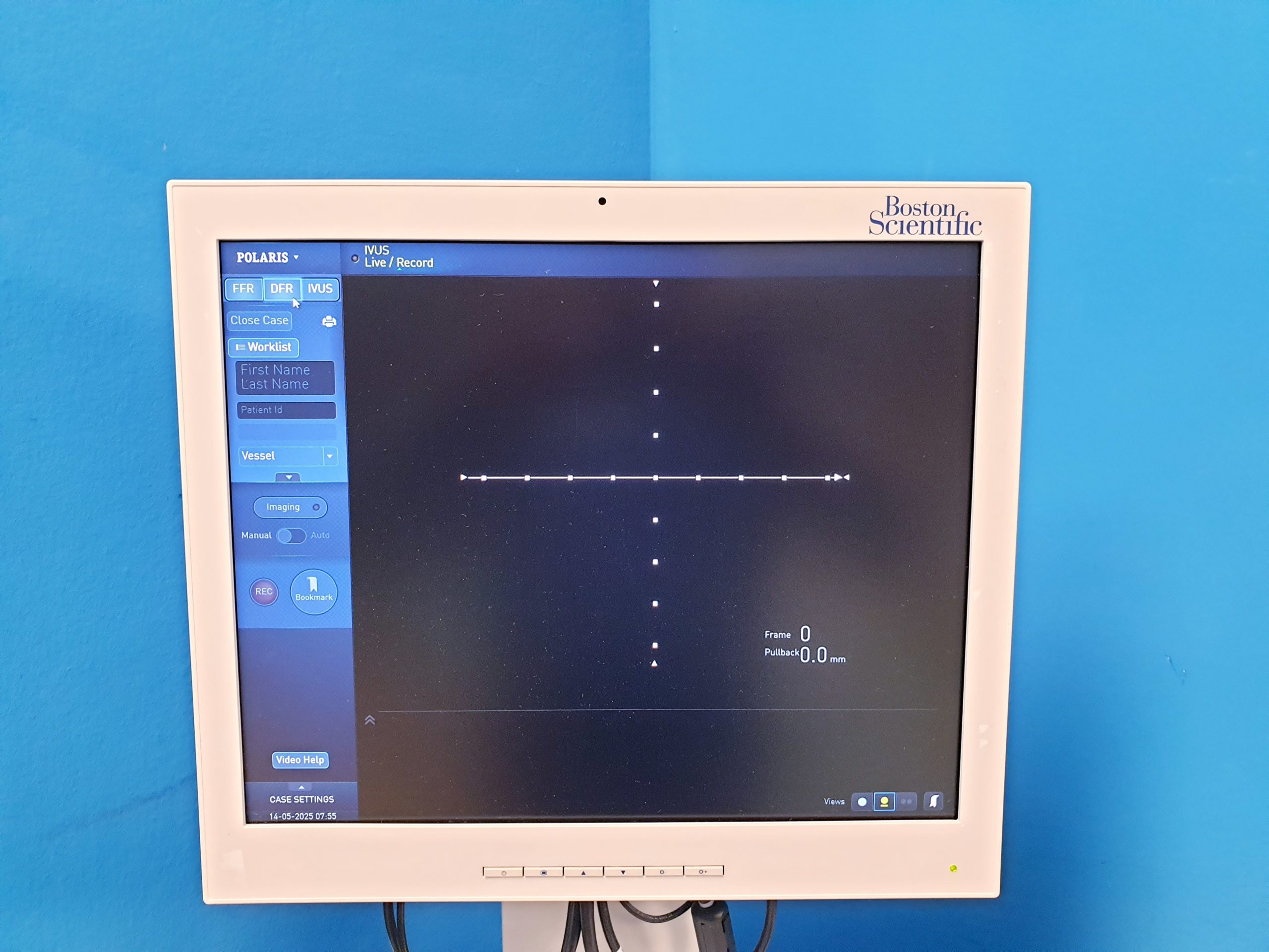 Boston Scientific iLab Ultrasound Imaging System – Bild 11