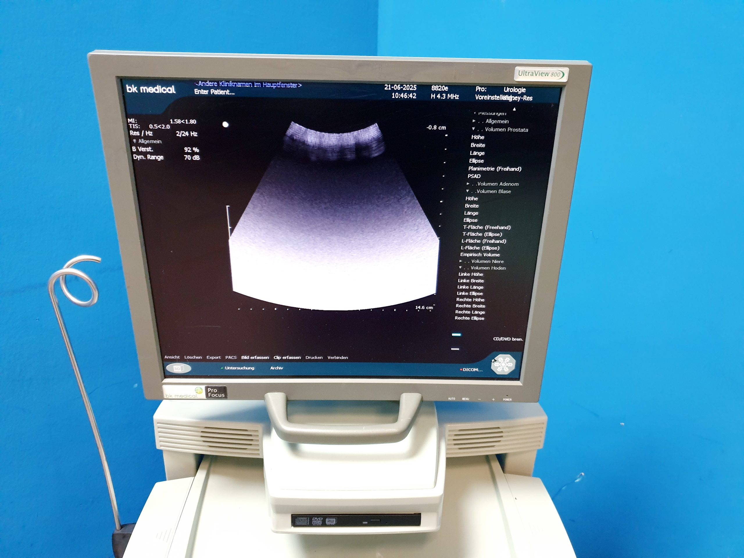 BK Medical 2202 + 8820e Konvex + 8811 Linear Ultraschallgerät – Bild 7