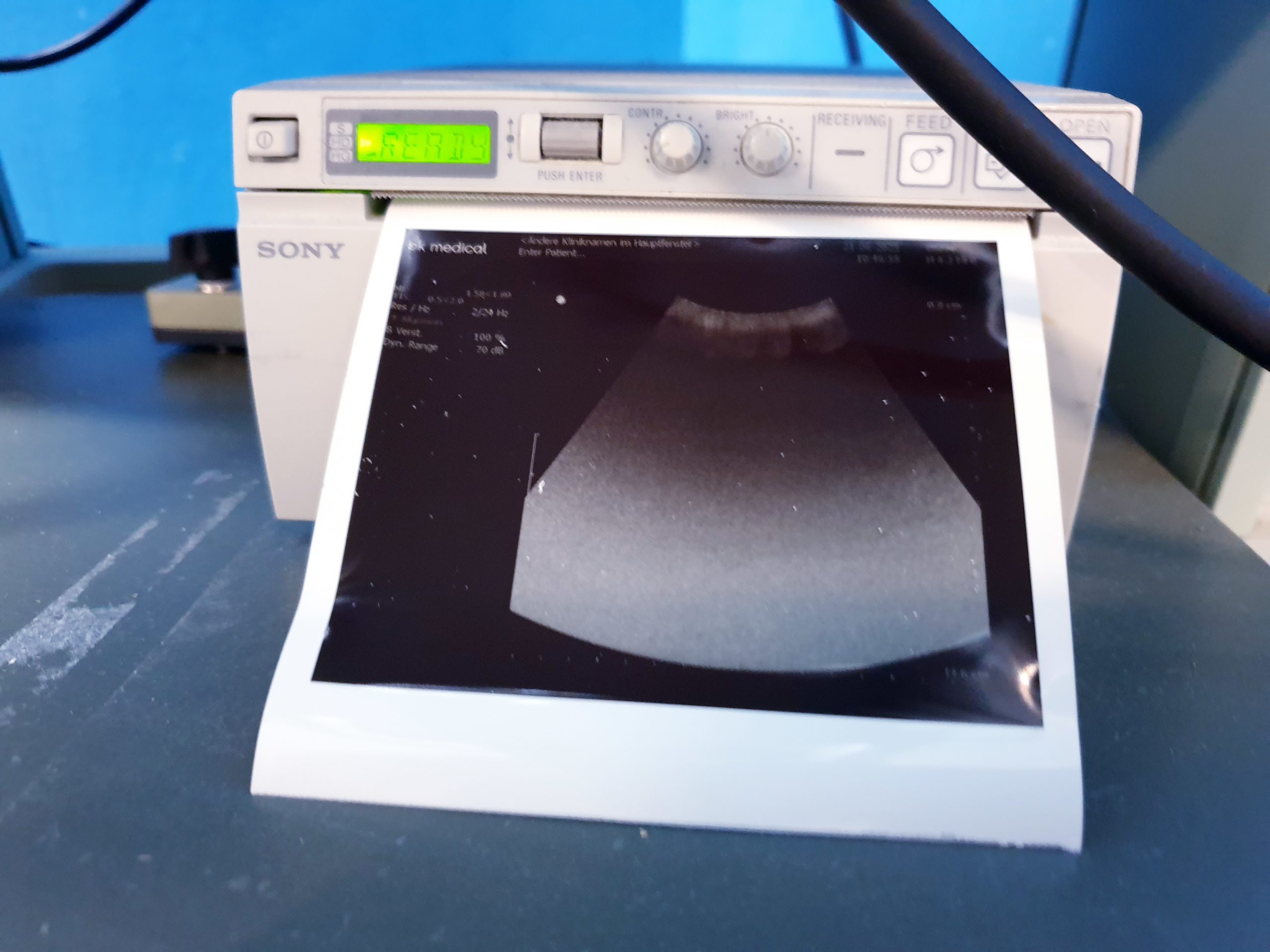 BK Medical 2202 + 8820e Konvex + 8811 Linear Ultraschallgerät – Bild 8