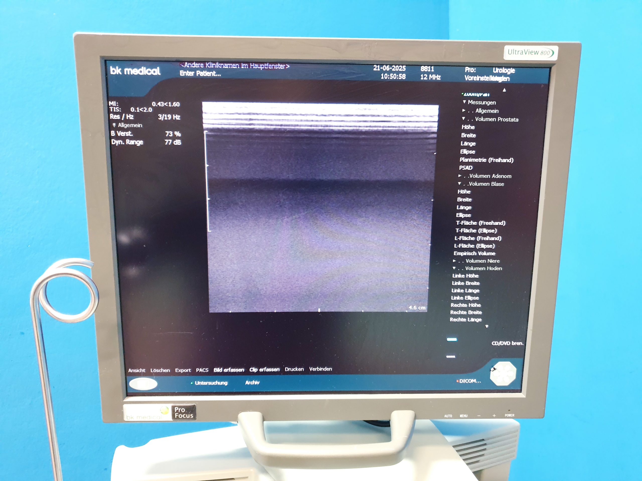 BK Medical 2202 + 8820e Konvex + 8811 Linear Ultraschallgerät – Bild 11