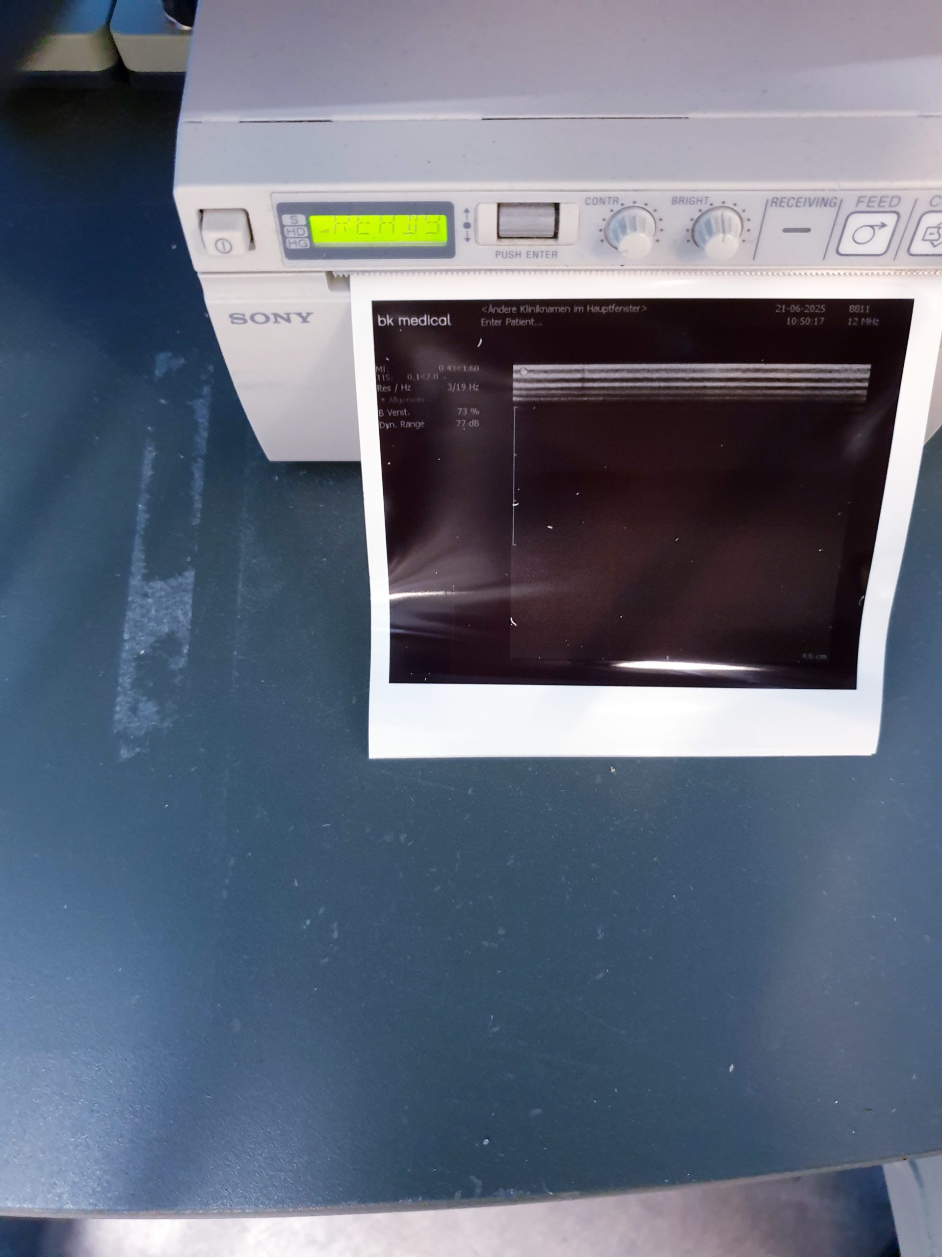 BK Medical 2202 + 8820e Konvex + 8811 Linear Ultraschallgerät – Bild 12