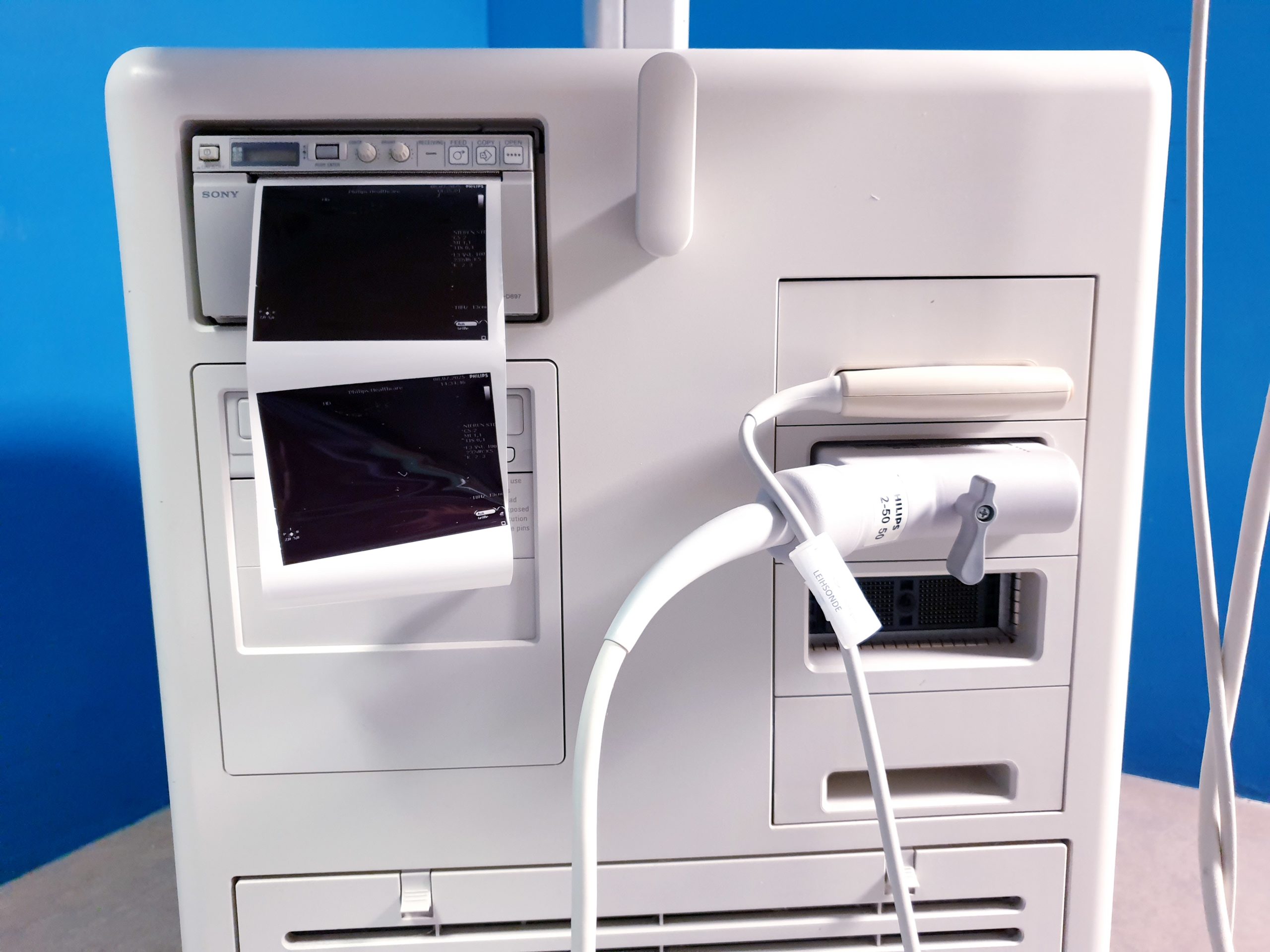 Philips HD7 XE Ultraschallgerät+Convexsonden +Linearesonden – Bild 17