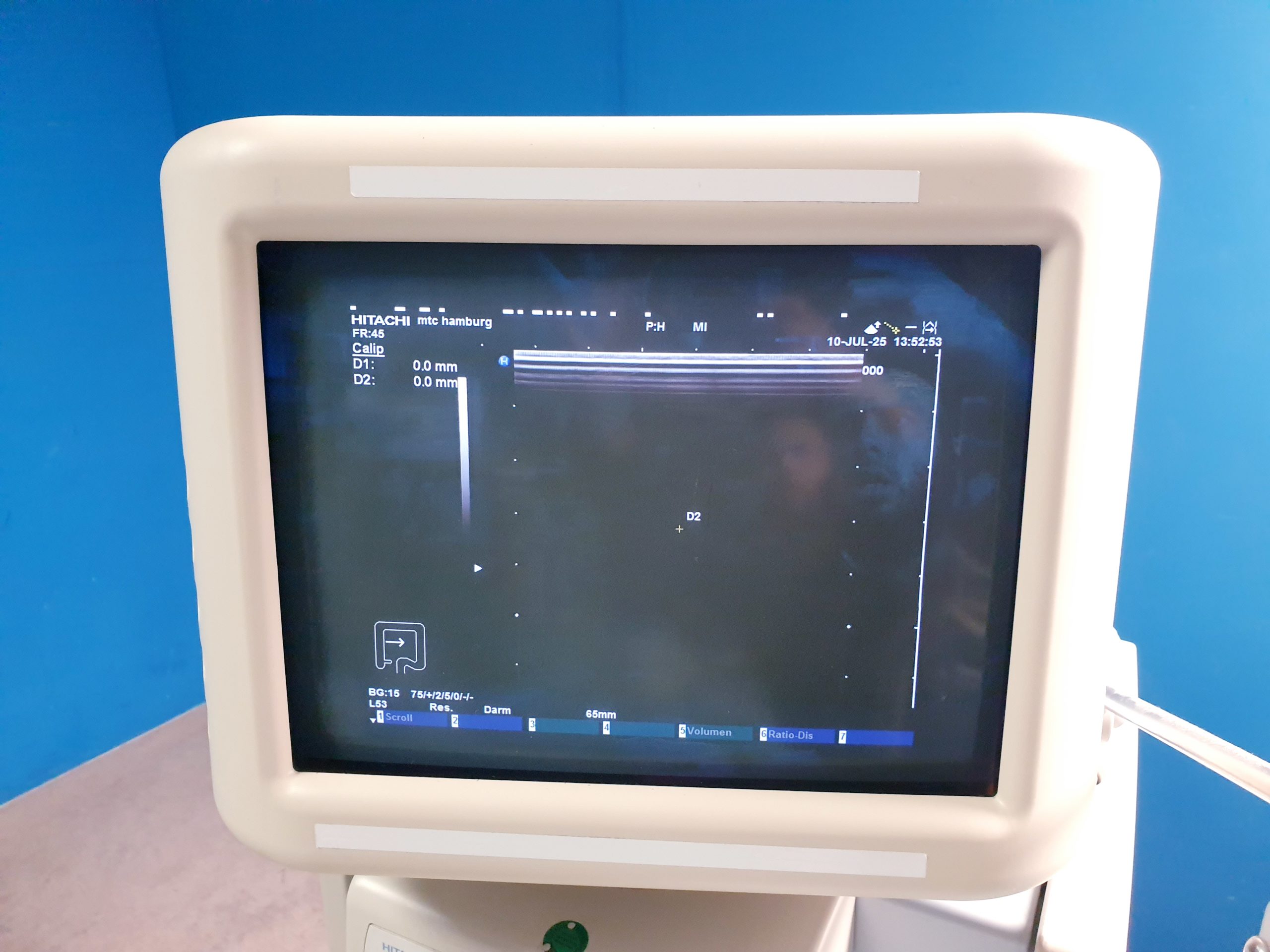 Mitsubishi P91 P 91 Monochrom Thermal Drucker Printer – Bild 5