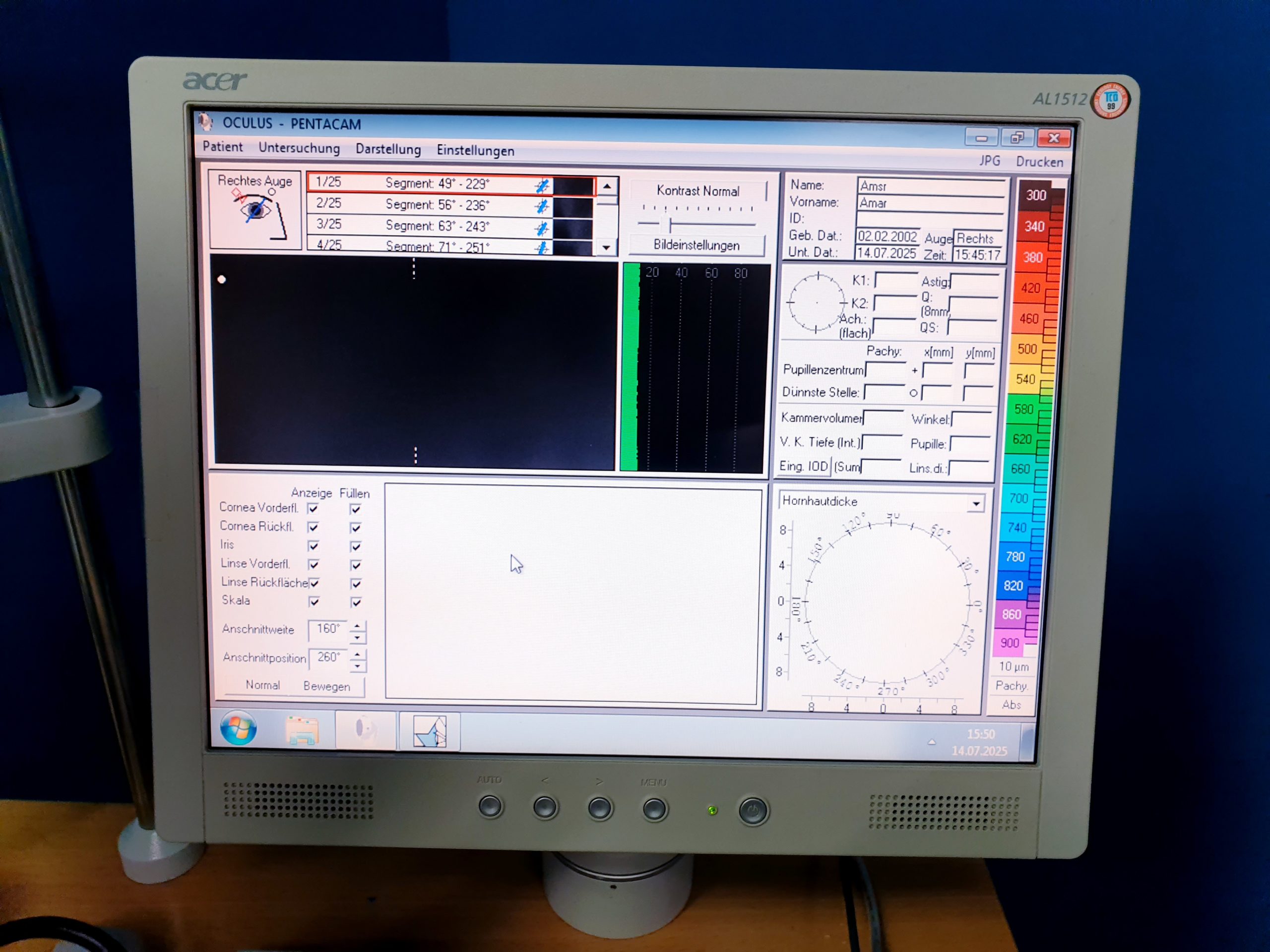 Oculus Pentacam 70700 Anterior Eye Segment Tomography System – Bild 6