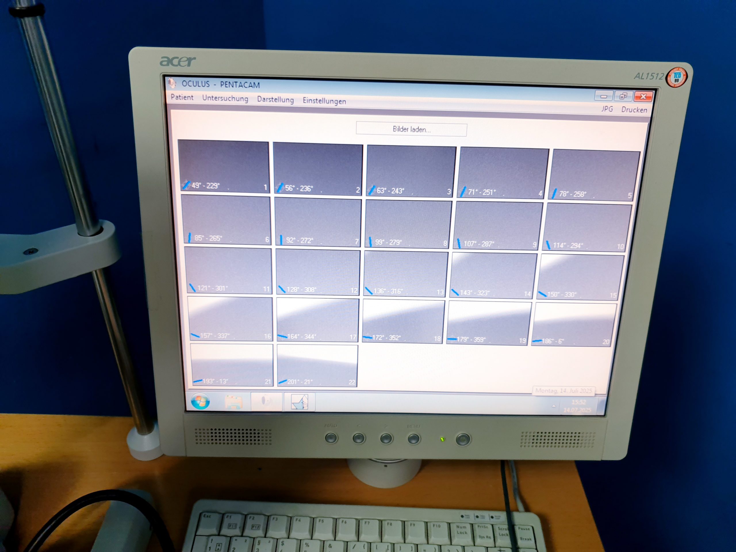 Oculus Pentacam 70700 Anterior Eye Segment Tomography System – Bild 8