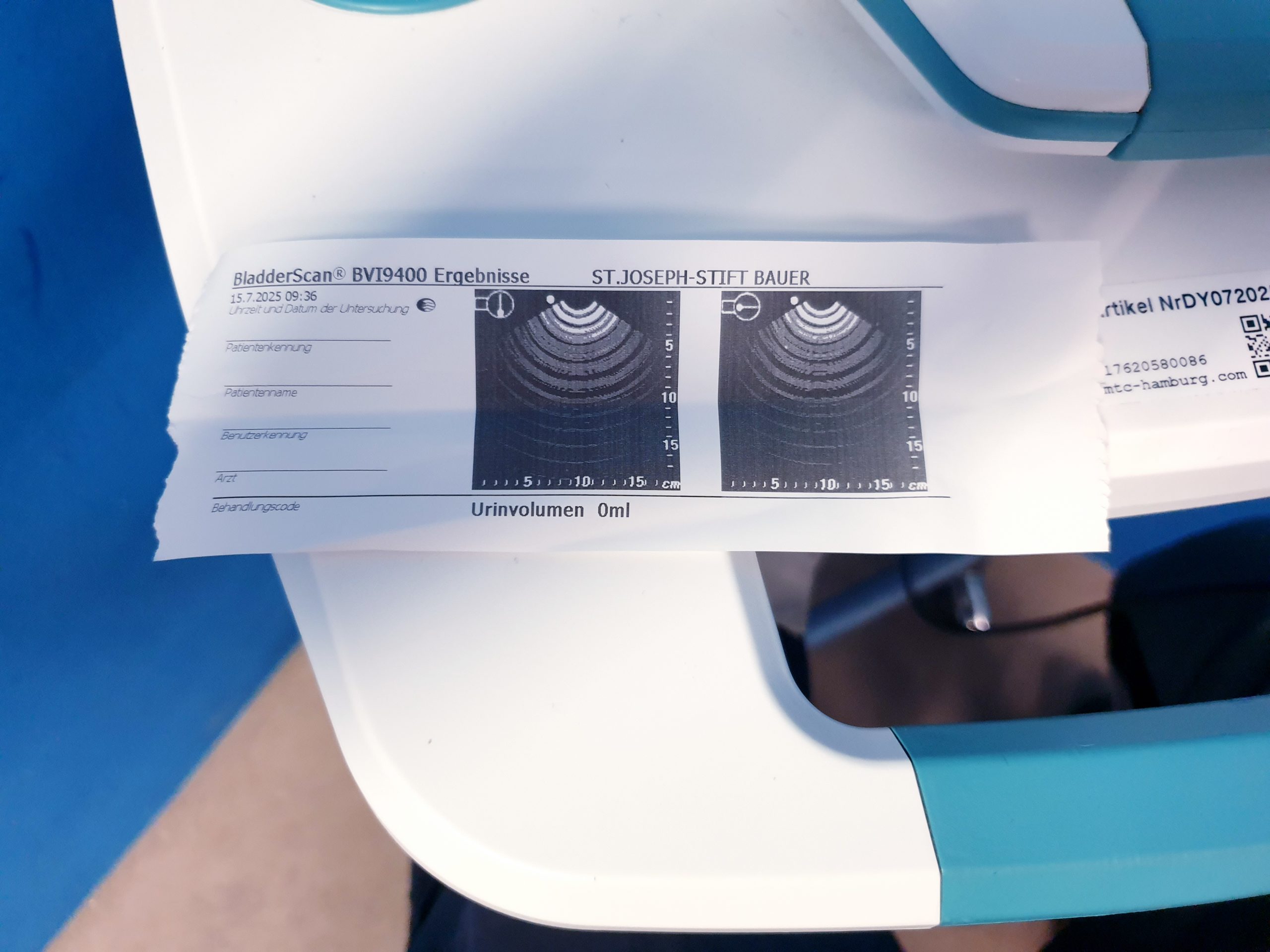 VERATHON BVI 9400 Blasenscanner – Bild 7