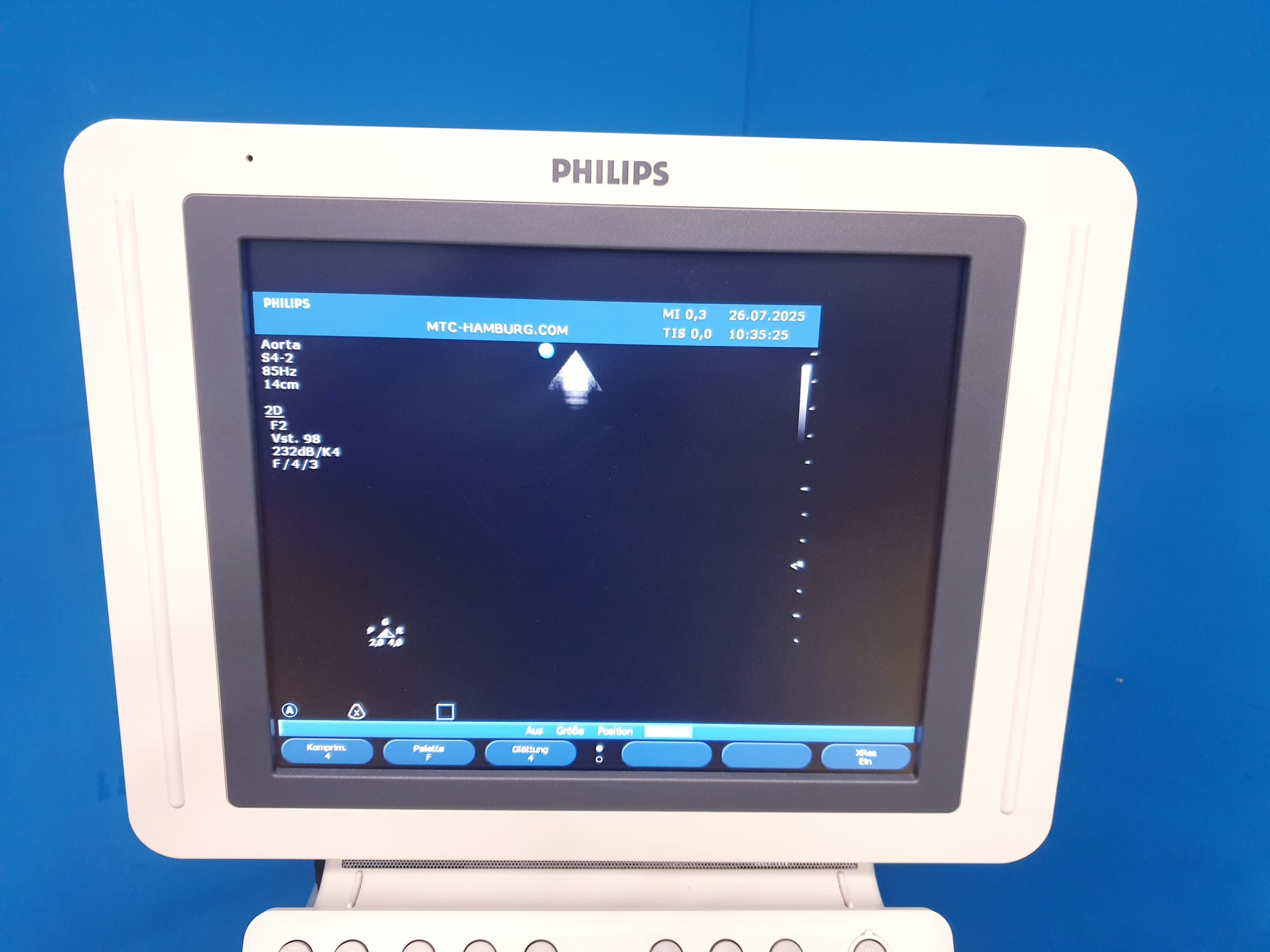 Philips HD11XE – HD 11 XE Farbdoppler+C5-2 Konvex+L12-5 Linear+ S4-2 array Sonde – Bild 8