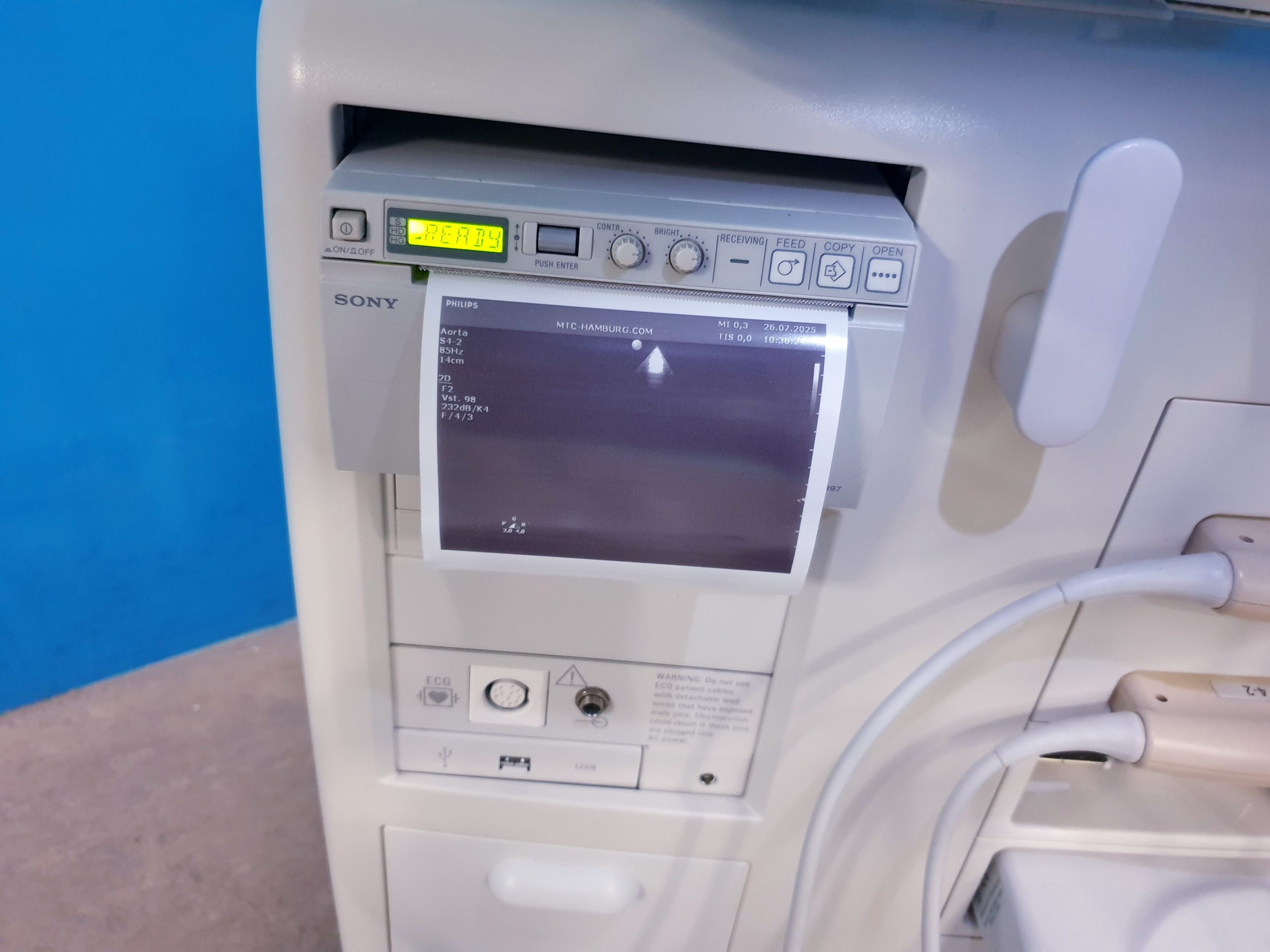 Philips HD11XE – HD 11 XE Farbdoppler+C5-2 Konvex+L12-5 Linear+ S4-2 array Sonde – Bild 9