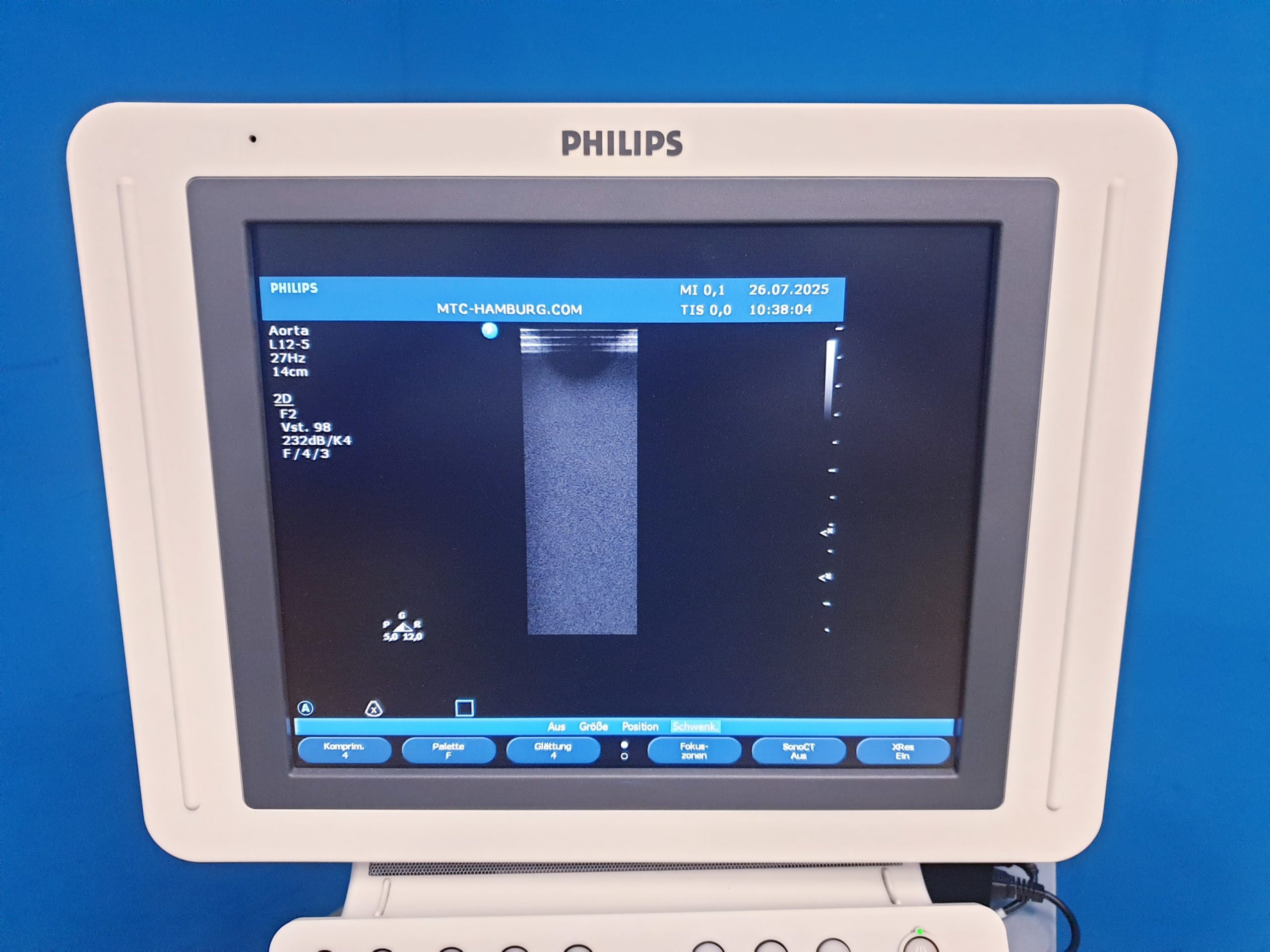 Philips HD11XE – HD 11 XE Farbdoppler+C5-2 Konvex+L12-5 Linear+ S4-2 array Sonde – Bild 13