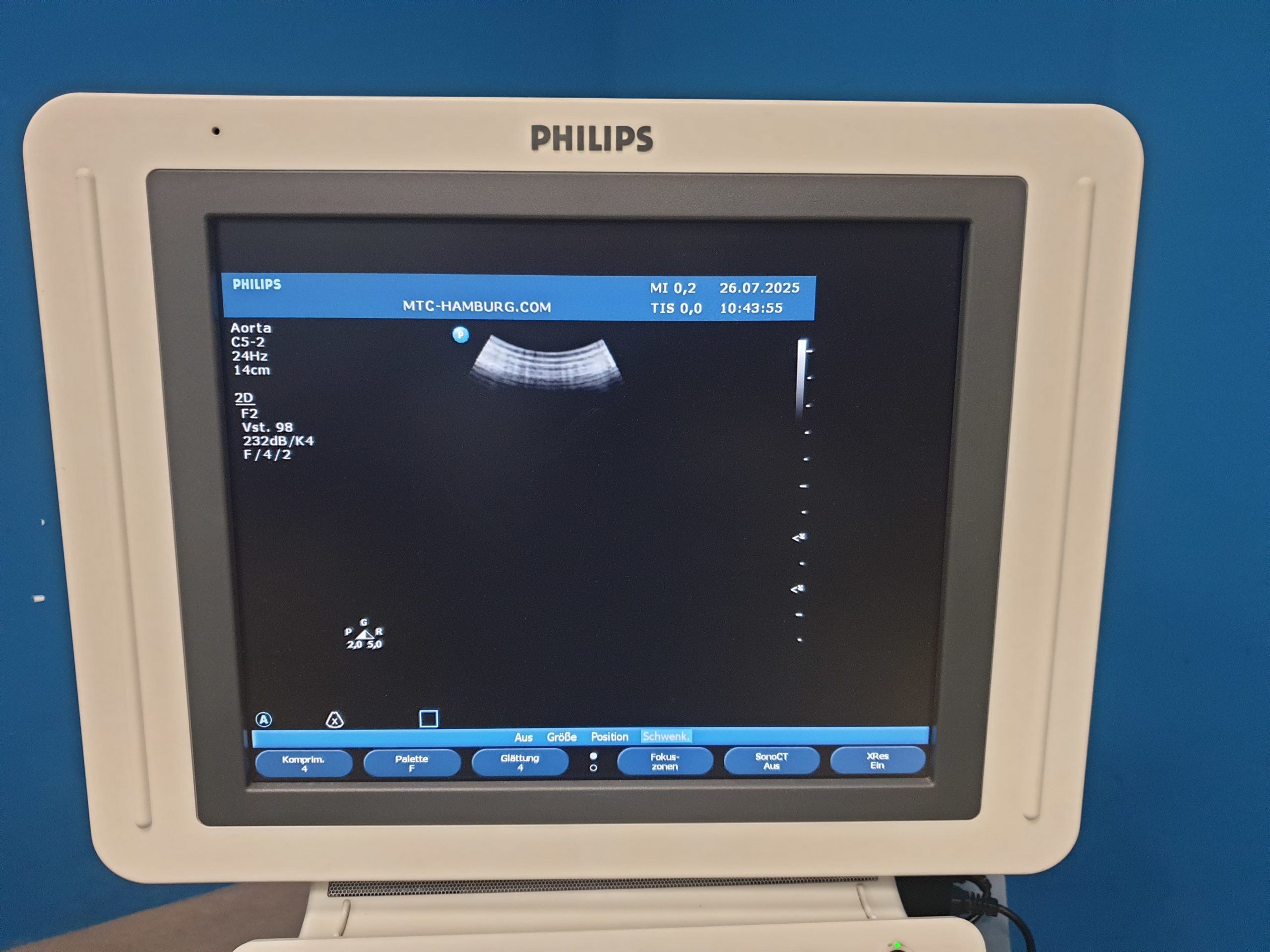 Philips HD11XE – HD 11 XE Farbdoppler+C5-2 Konvex+L12-5 Linear+ S4-2 array Sonde – Bild 17