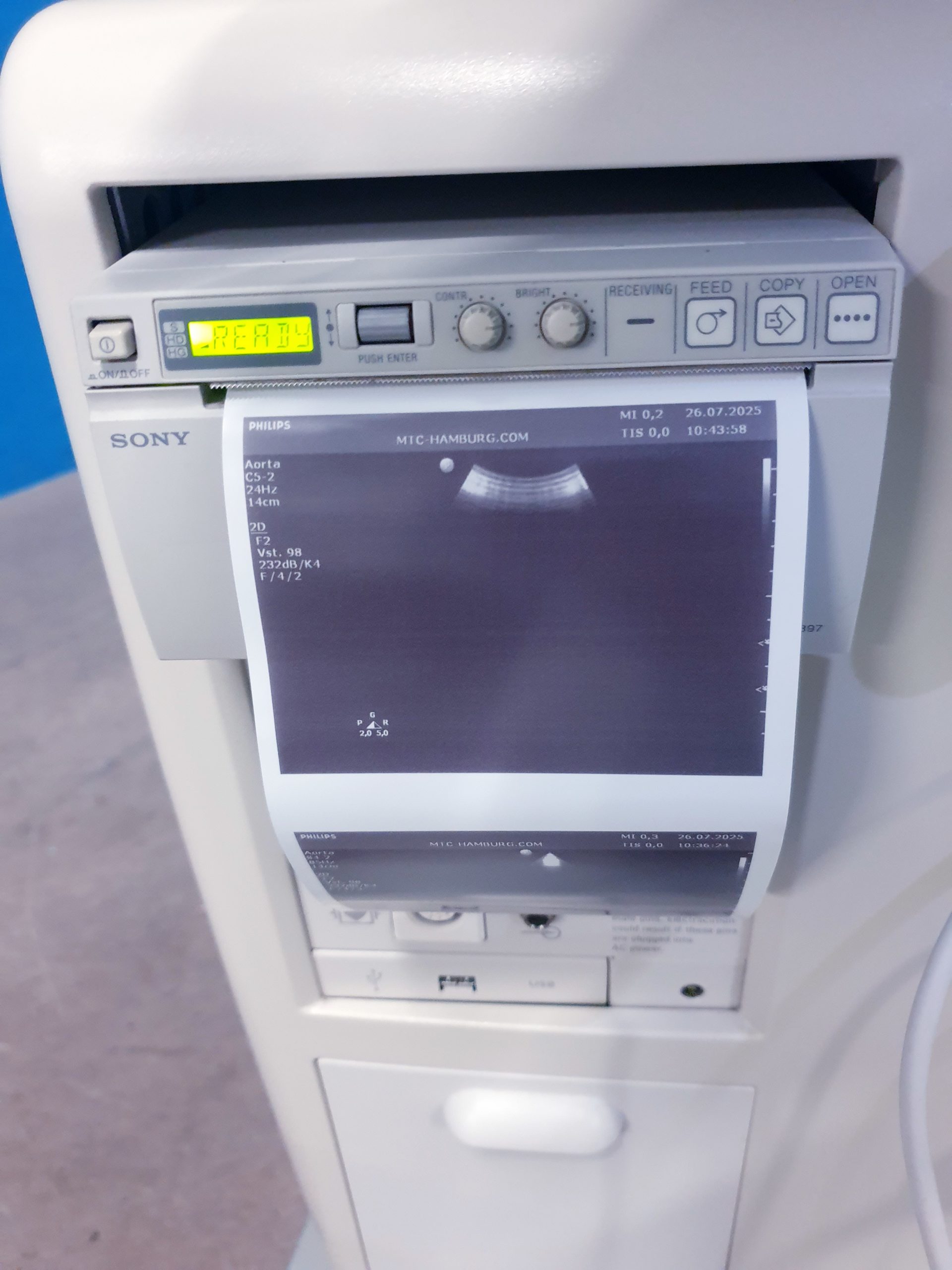 Philips HD11XE – HD 11 XE Farbdoppler+C5-2 Konvex+L12-5 Linear+ S4-2 array Sonde – Bild 18