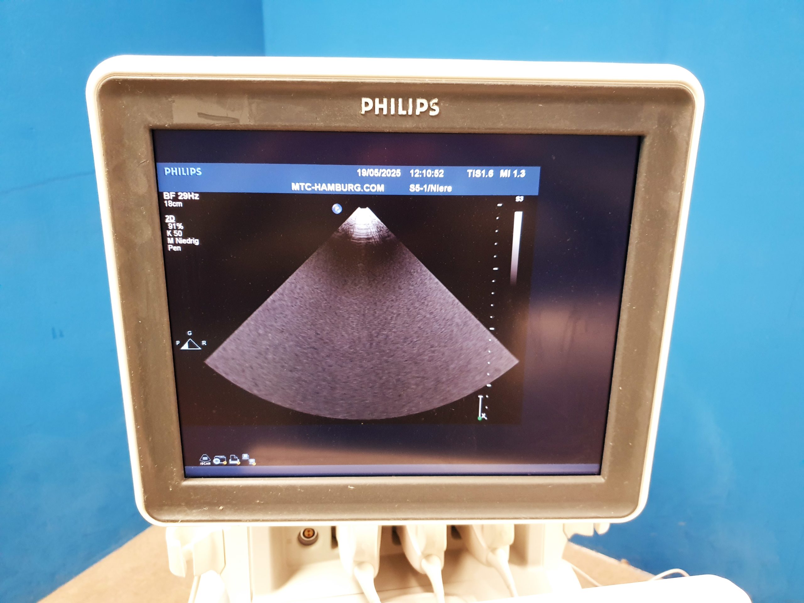 Philips iE33 – IE33 + S5-1 Echo + L11-3 Linear Sonde + C5-2 Konvex - Kardiomaschine – Kardio Ultraschallgerät – Bild 11