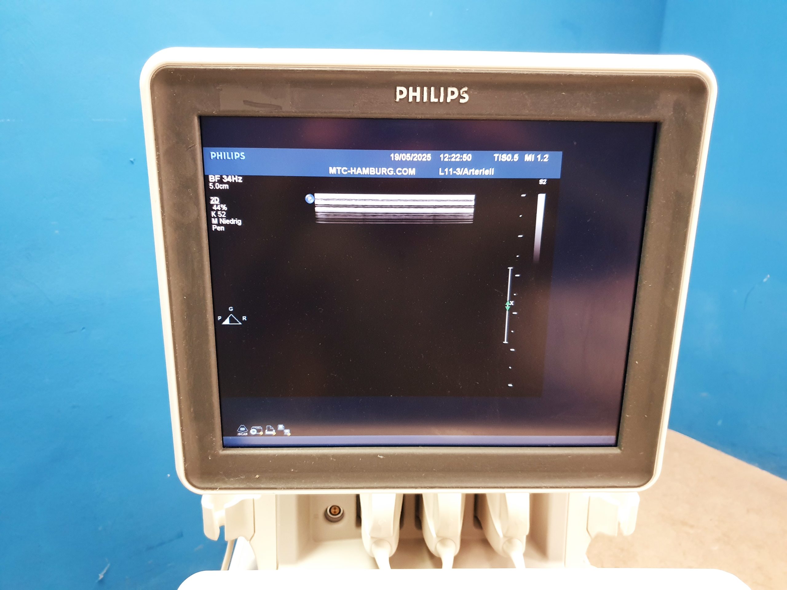 Philips iE33 – IE33 + S5-1 Echo + L11-3 Linear Sonde + C5-2 Konvex - Kardiomaschine – Kardio Ultraschallgerät – Bild 23