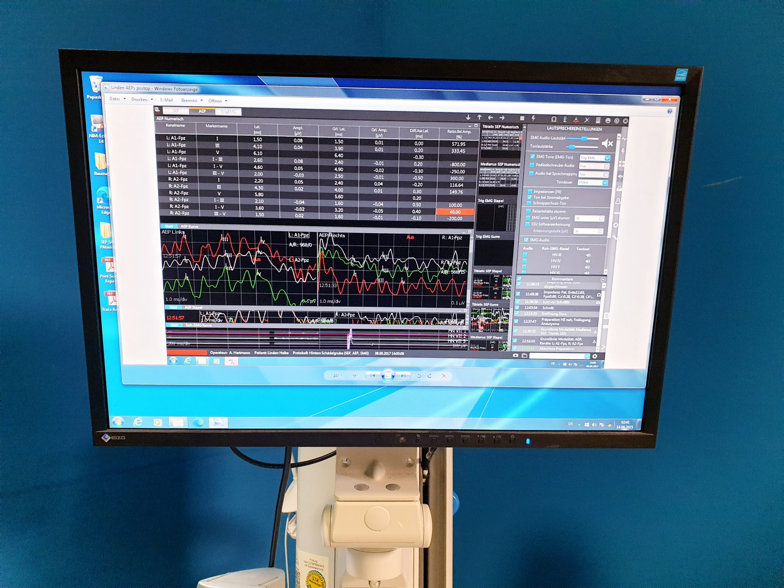 Medtronic NIM Eclipse E4 Nerven Monitoring System – Bild 21