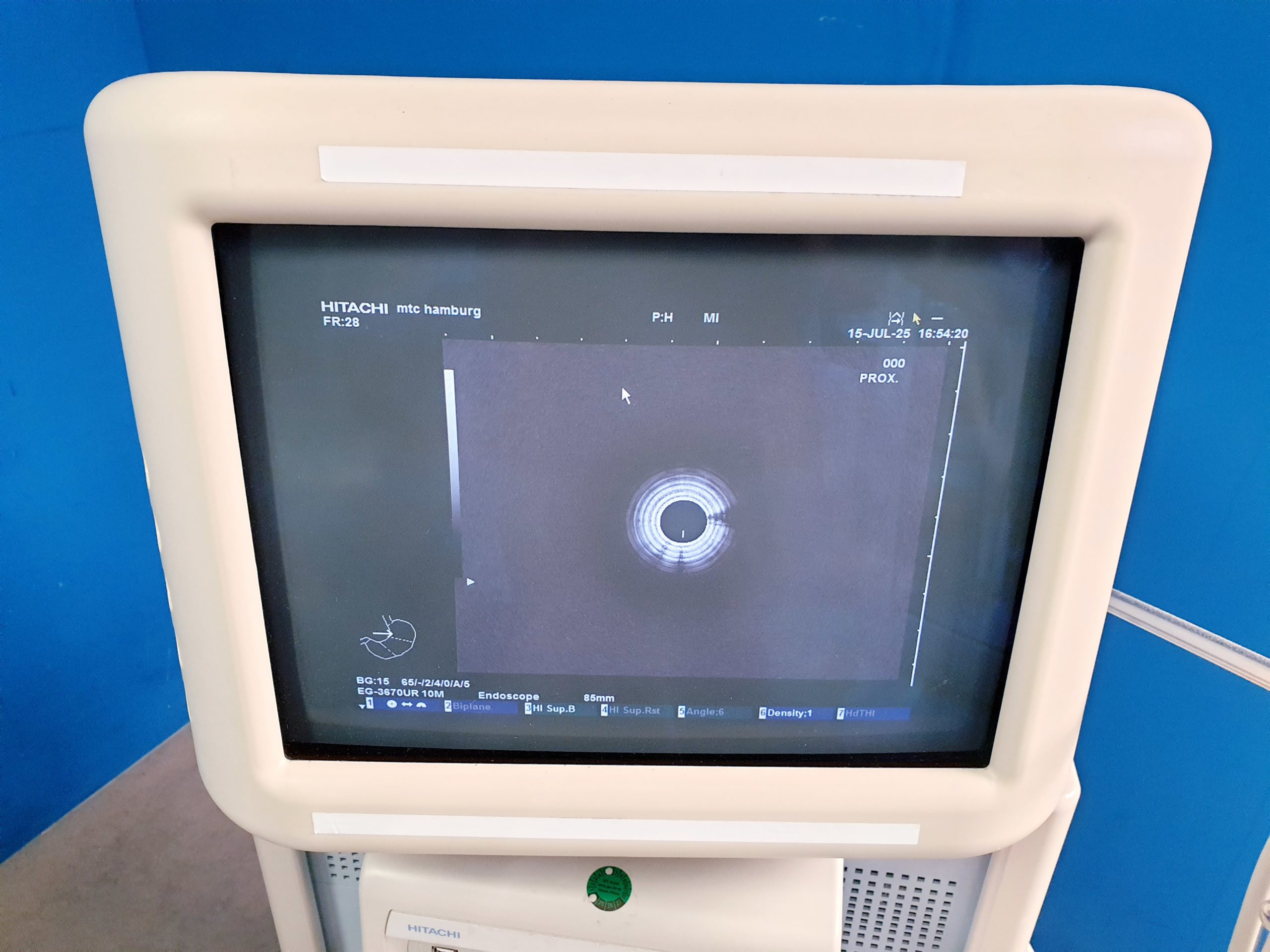 Pentax EG-3670URK – EG 3670 URK Ultraschall Gastroskop – Bild 7