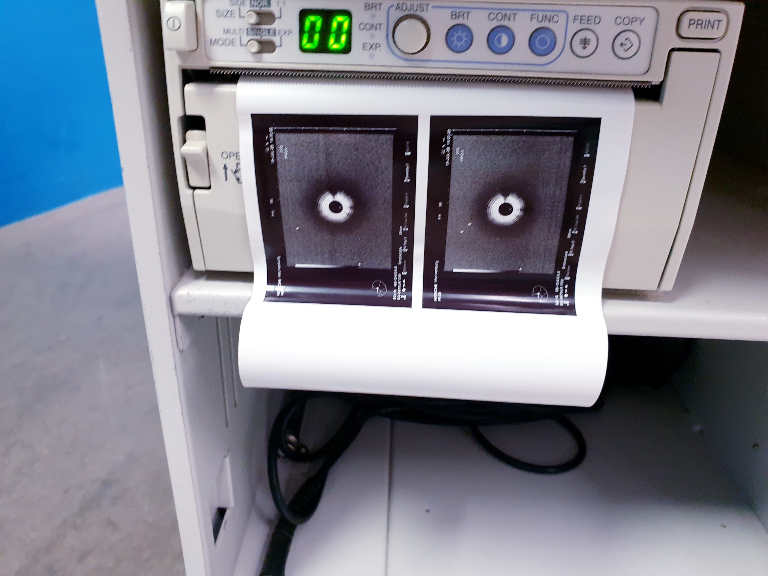 Pentax EG-3670URK – EG 3670 URK Ultraschall Gastroskop – Bild 8