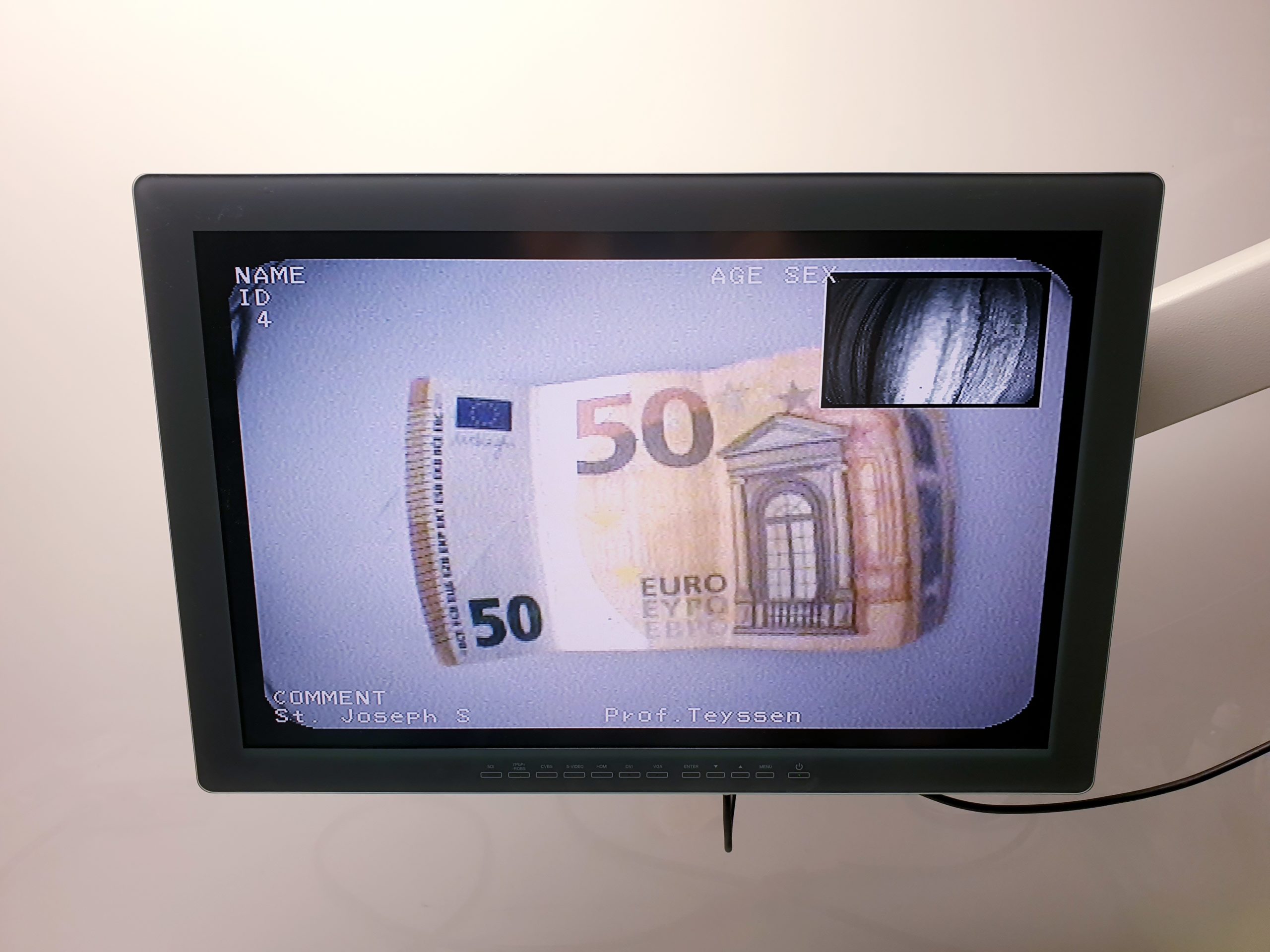 Pentax EG-3670URK – EG 3670 URK Ultraschall Gastroskop – Bild 9