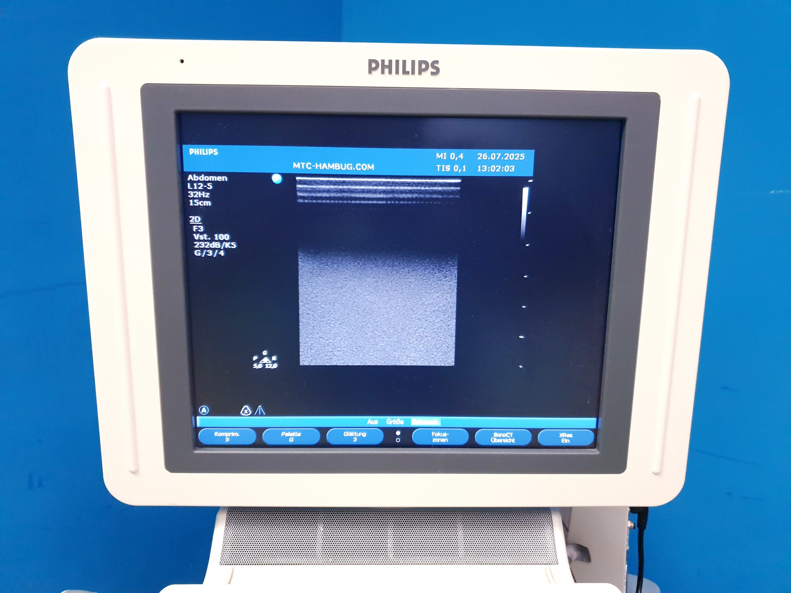 Philips HD11XE – HD 11 XE Farbdoppler+C5-2 Konvex+L12-3 Linear+ Pencil D5cwc CW Sonde – Bild 8