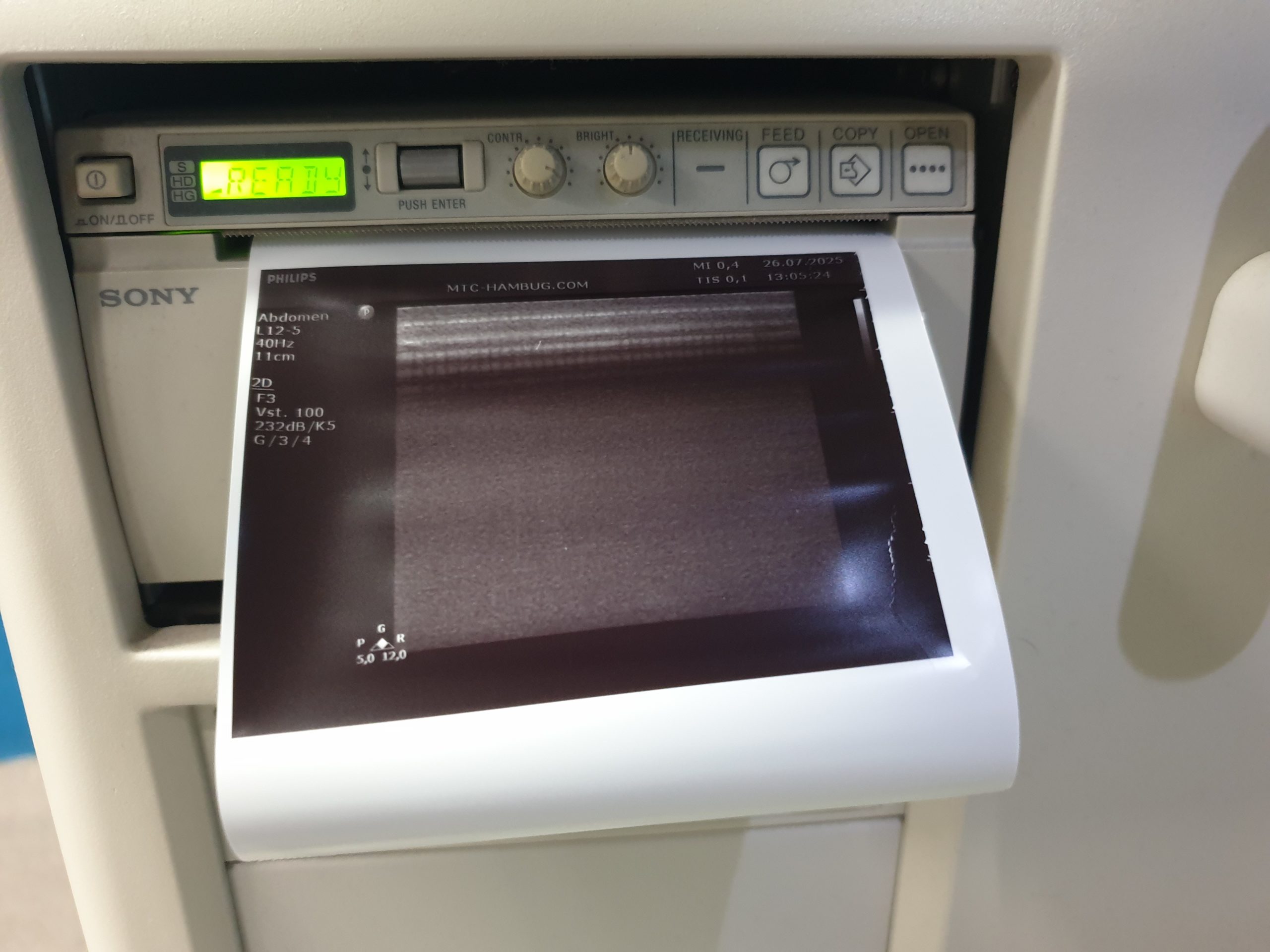 Philips HD11XE – HD 11 XE Farbdoppler+C5-2 Konvex+L12-3 Linear+ Pencil D5cwc CW Sonde – Bild 10