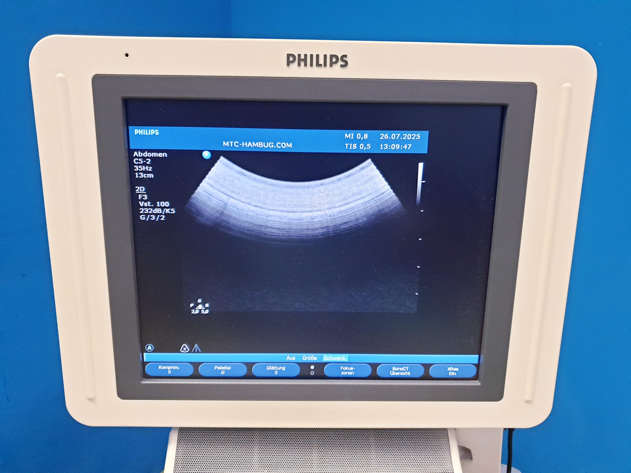 Philips HD11XE – HD 11 XE Farbdoppler+C5-2 Konvex+L12-3 Linear+ Pencil D5cwc CW Sonde – Bild 16