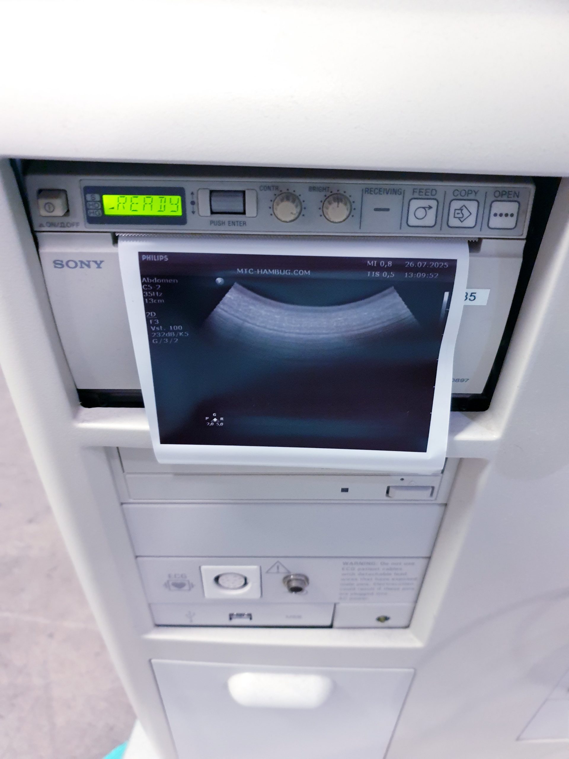 Philips HD11XE – HD 11 XE Farbdoppler+C5-2 Konvex+L12-3 Linear+ Pencil D5cwc CW Sonde – Bild 17