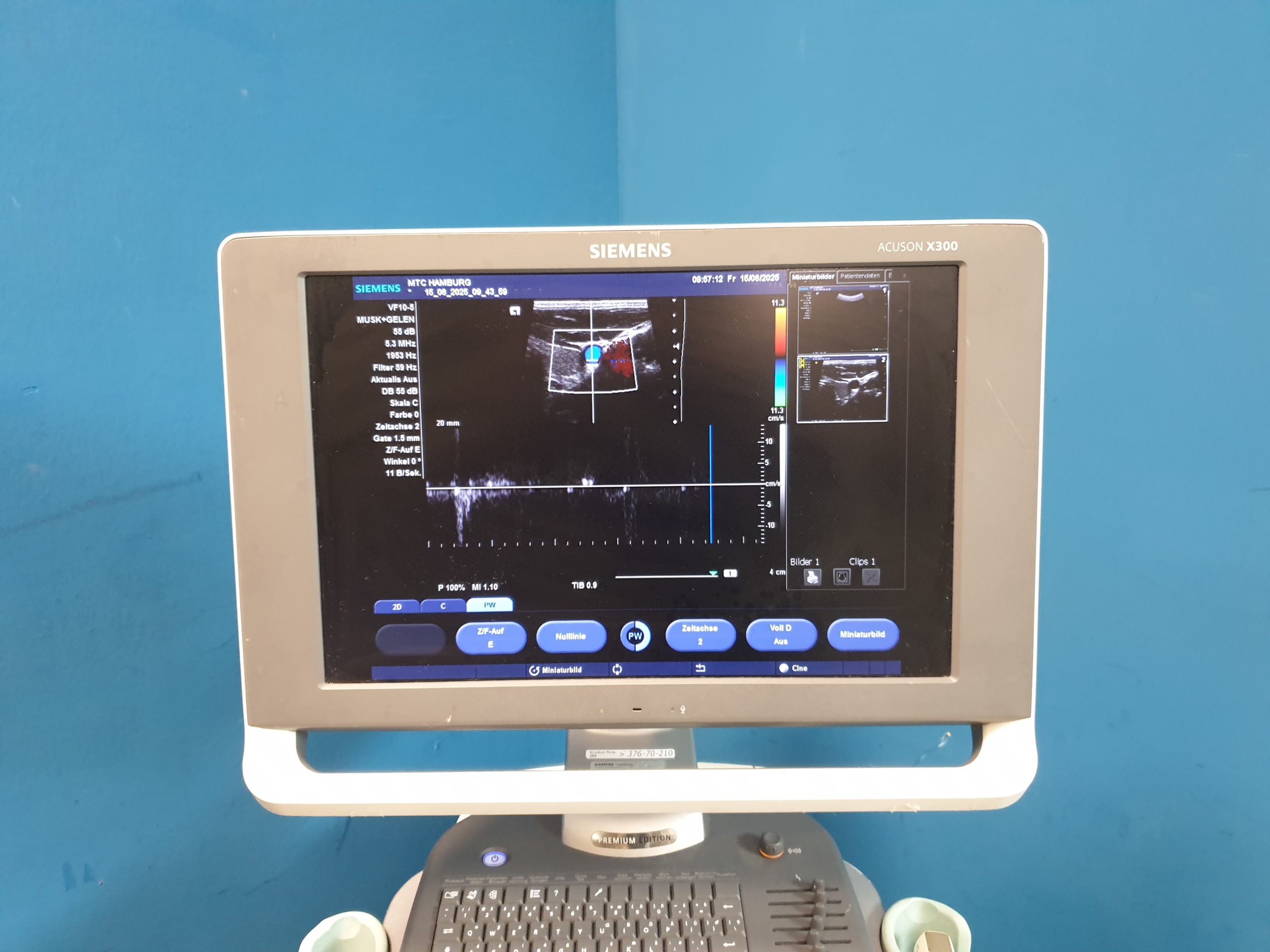SIEMENS ACUSON X300 X 300 Premium Edition + CH5-2 Konvex + VF10-5 Linear + P5-1 – Bild 4