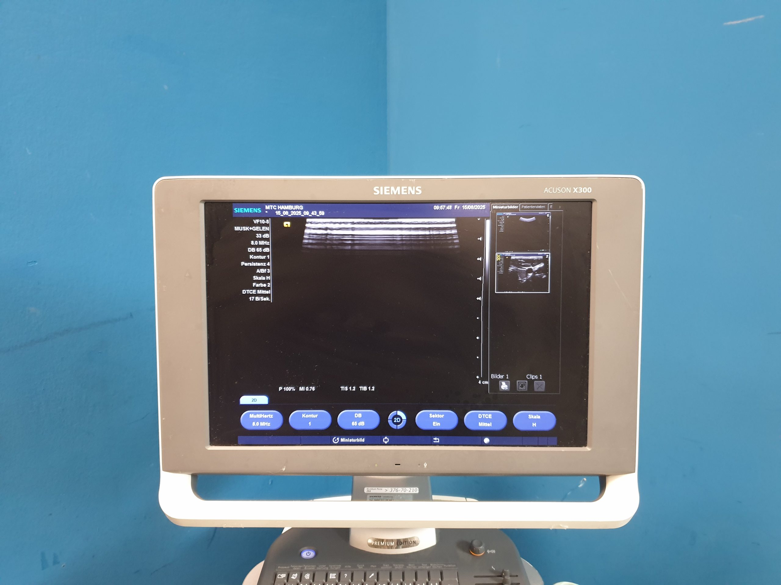 SIEMENS ACUSON X300 X 300 Premium Edition + CH5-2 Konvex + VF10-5 Linear + P5-1 – Bild 9