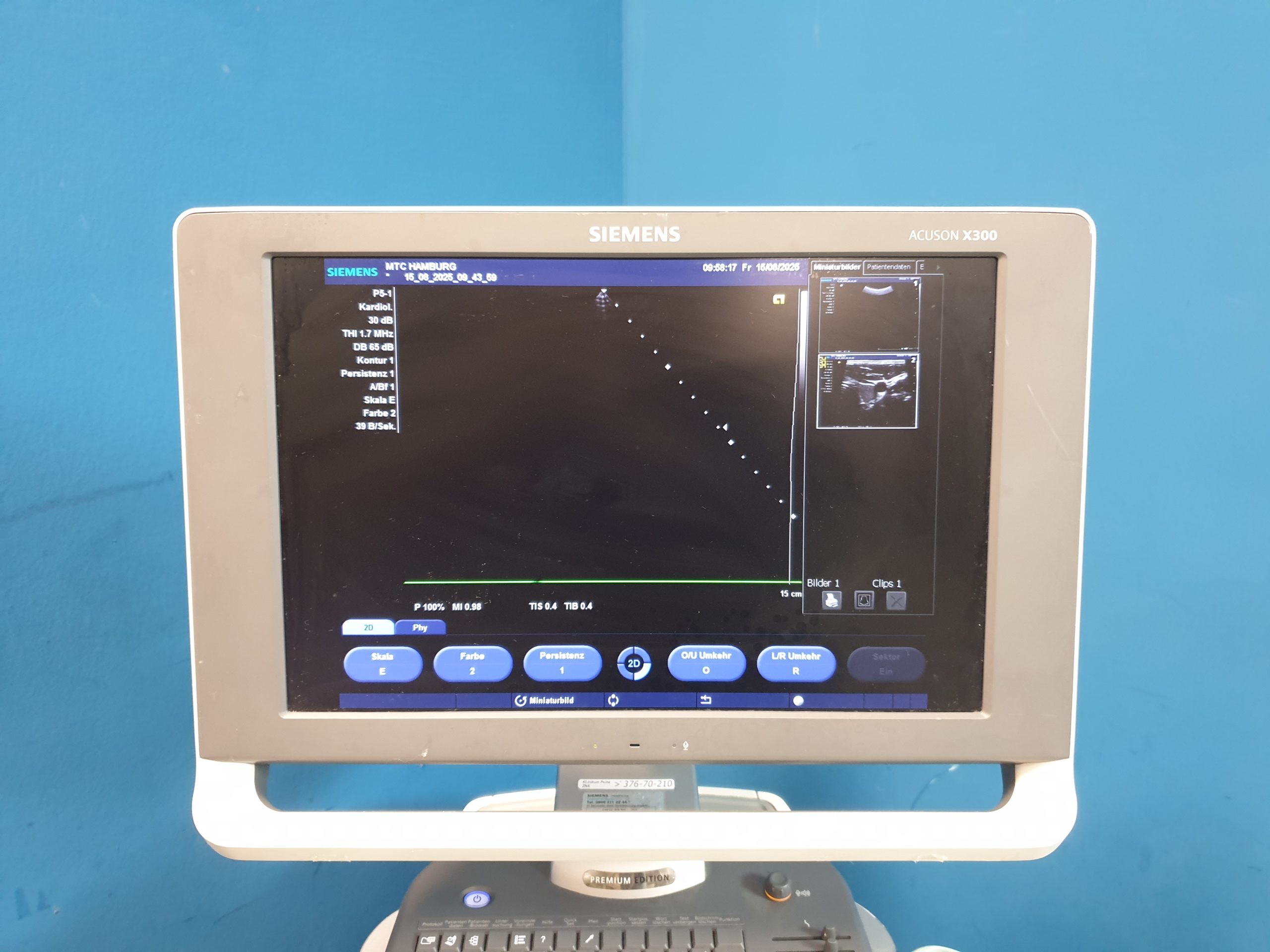 SIEMENS ACUSON X300 X 300 Premium Edition + CH5-2 Konvex + VF10-5 Linear + P5-1 – Bild 12