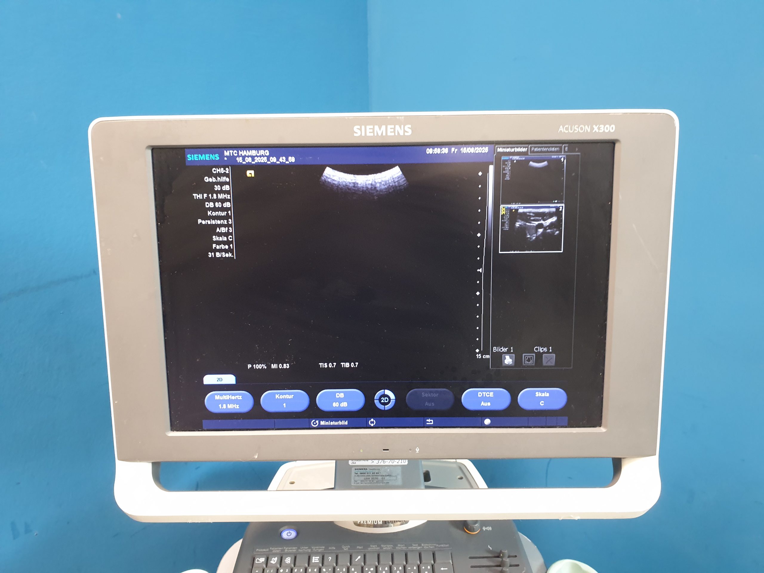 SIEMENS ACUSON X300 X 300 Premium Edition + CH5-2 Konvex + VF10-5 Linear + P5-1 – Bild 15