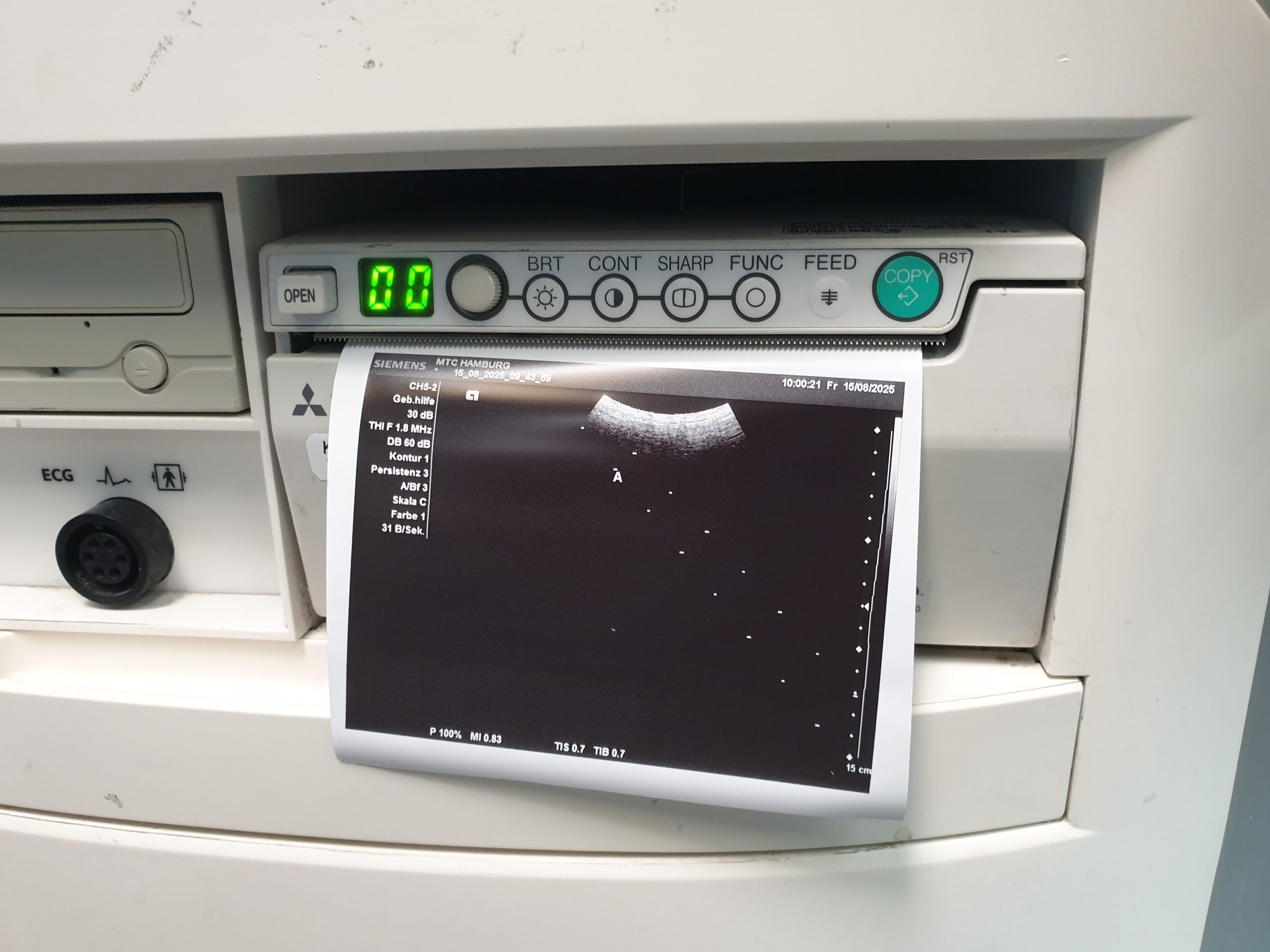 SIEMENS ACUSON X300 X 300 Premium Edition + CH5-2 Konvex + VF10-5 Linear + P5-1 – Bild 20