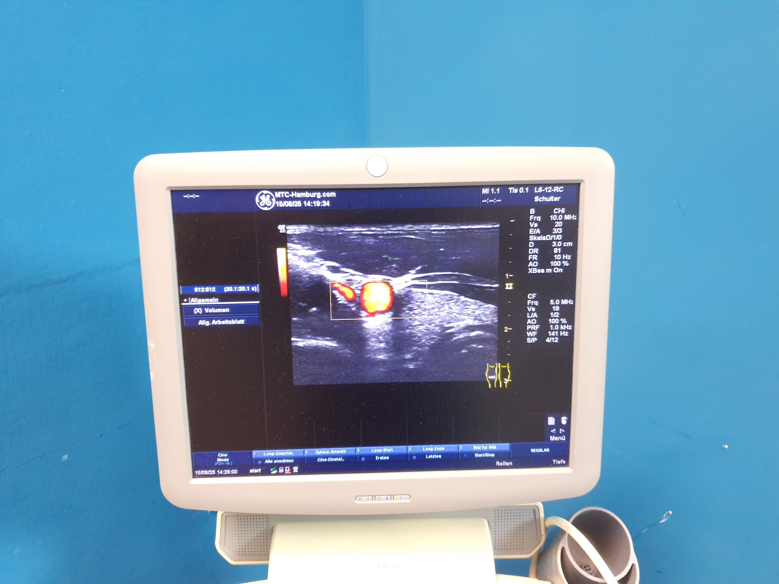 GE Logiq C5 Premium + L6-12-RS Linear Sonde - DOM 2016 – Bild 5