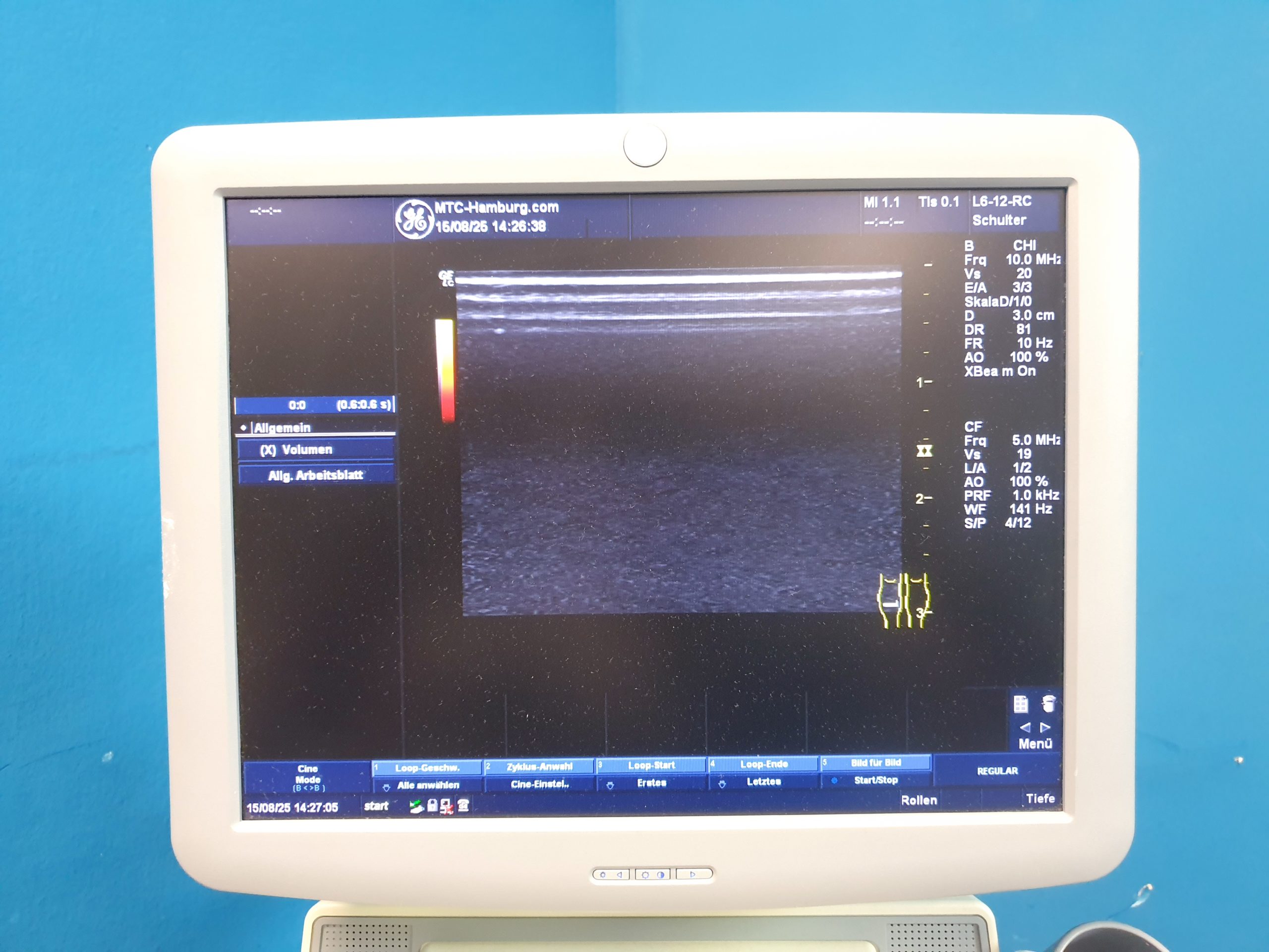 GE Logiq C5 Premium + L6-12-RS Linear Sonde - DOM 2016 – Bild 12