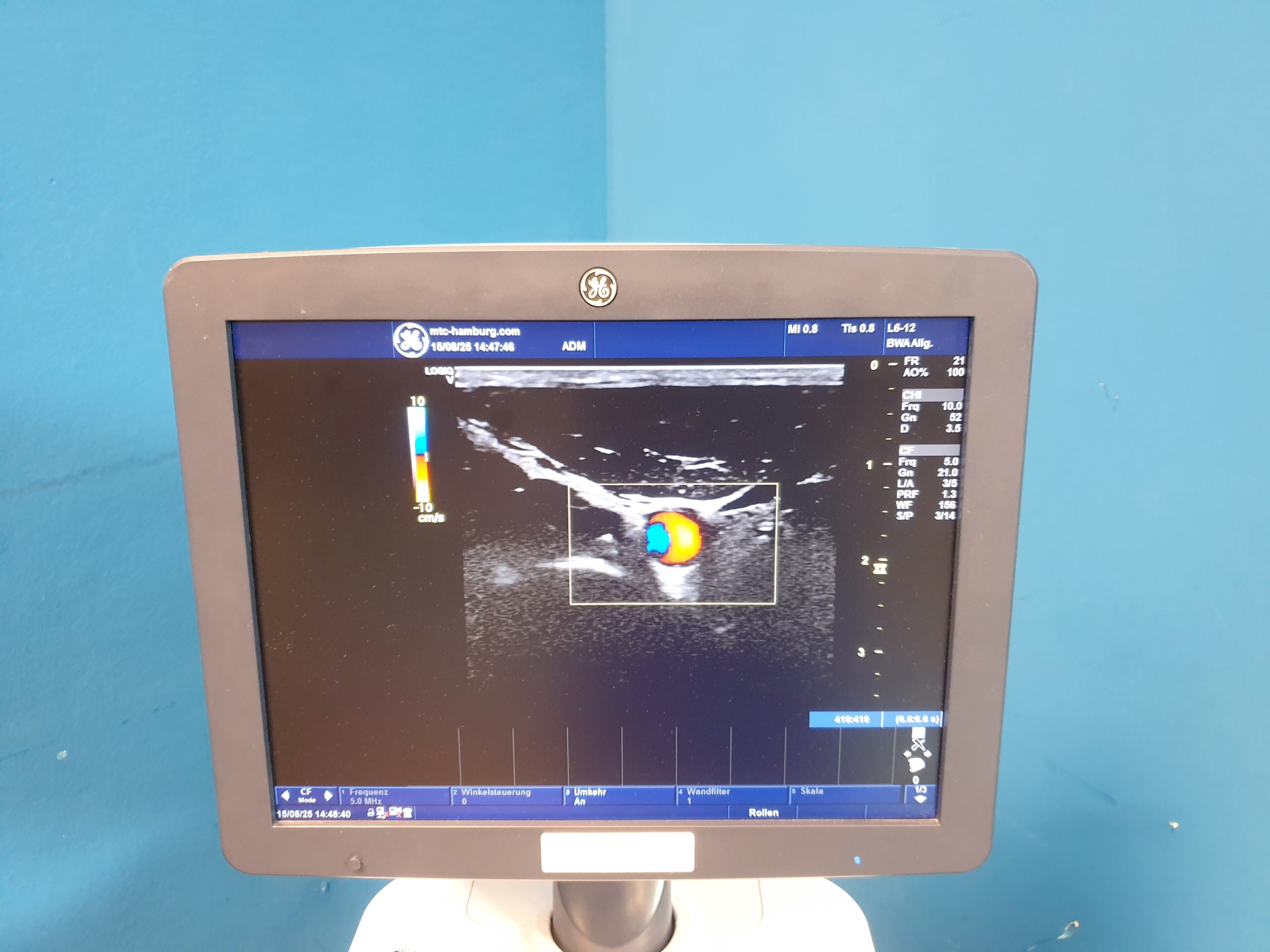 GE Logiq V5 Expert Ultraschallgerät + L6-12 RS Linear Sonde DOM 2016 – Bild 16